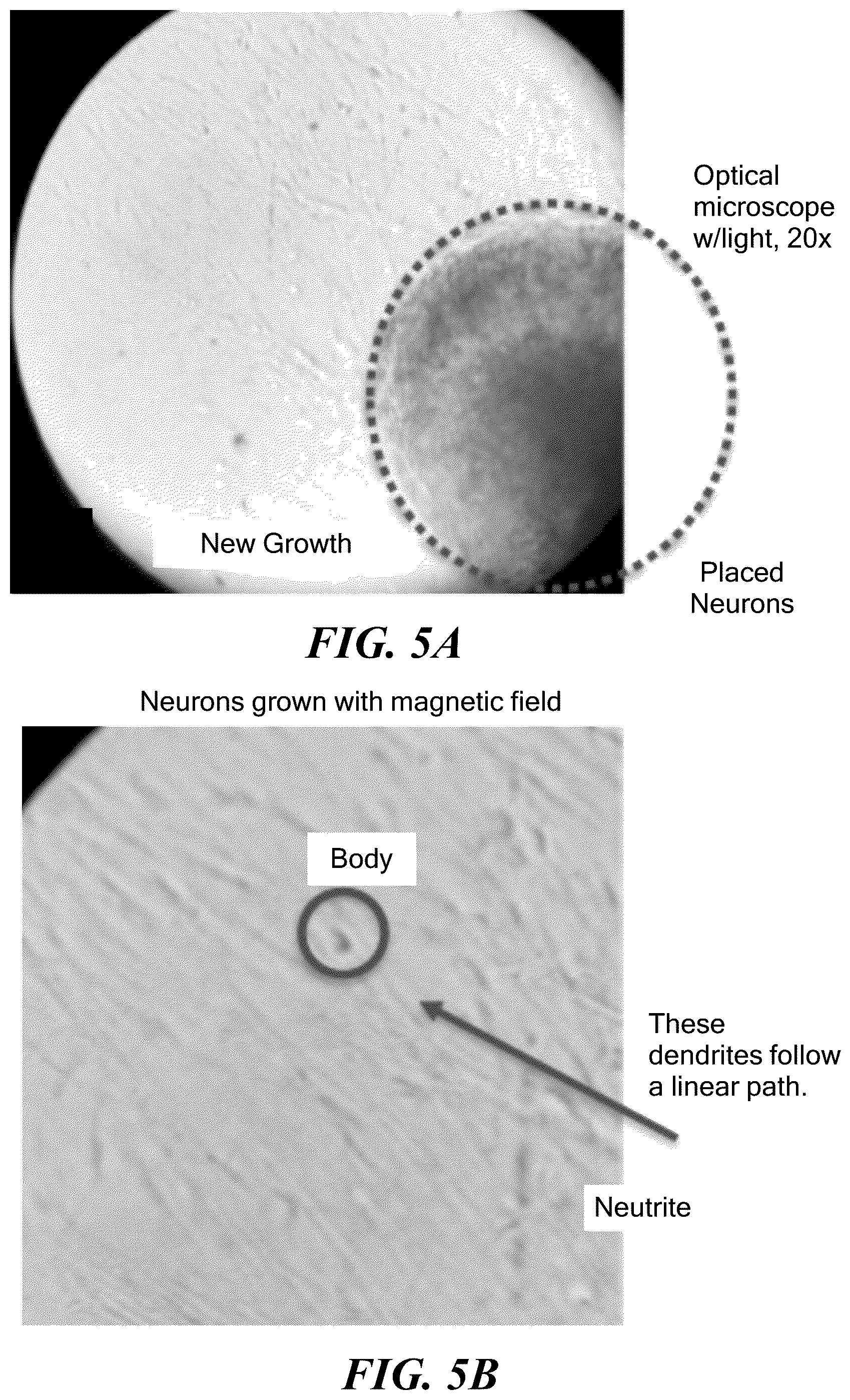 Patent US12350510 Figure 5 – Magnetic microwires for energy-transporting biomedical applications