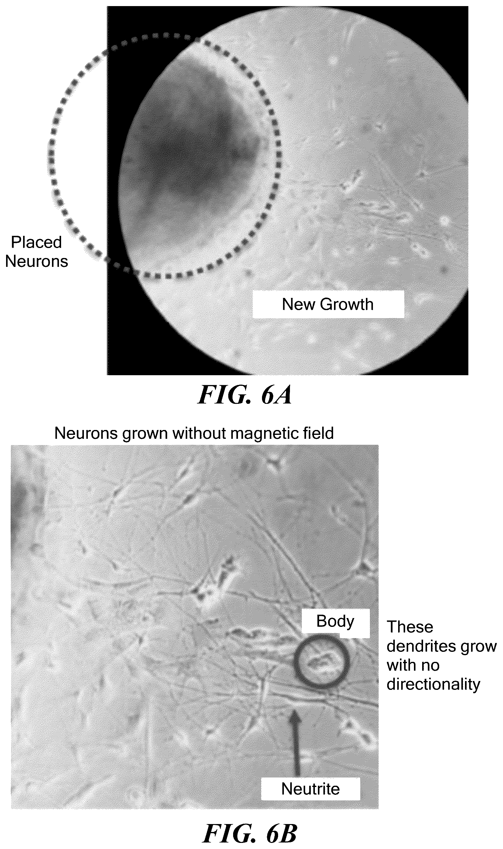 Patent US12350510 Figure 6 – Magnetic microwires for energy-transporting biomedical applications