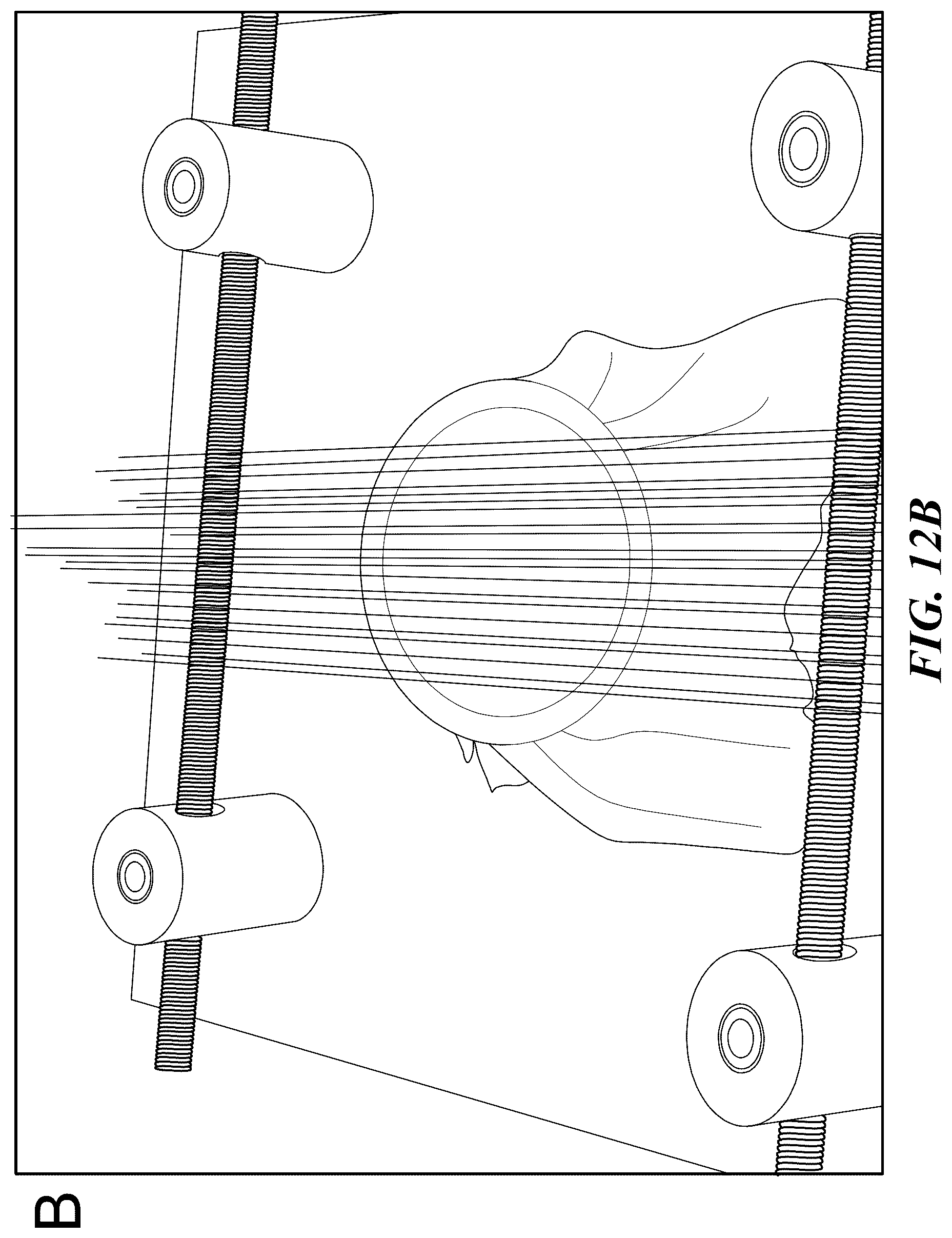 Patent US12350510 Figure 12 – Magnetic microwires for energy-transporting biomedical applications