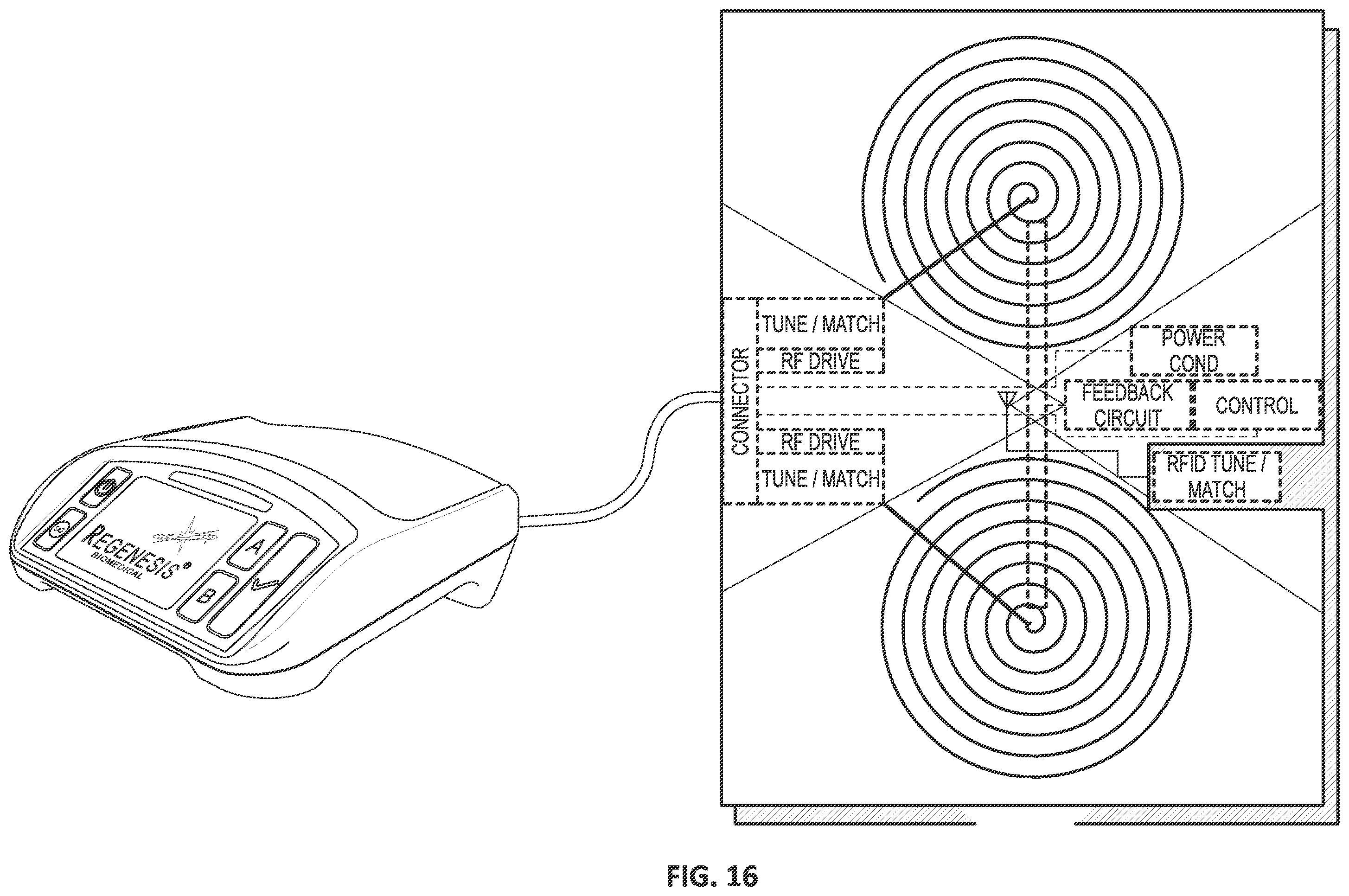 Patent US12350511 Figure 17 – High-power pulsed electromagnetic field applicator system
