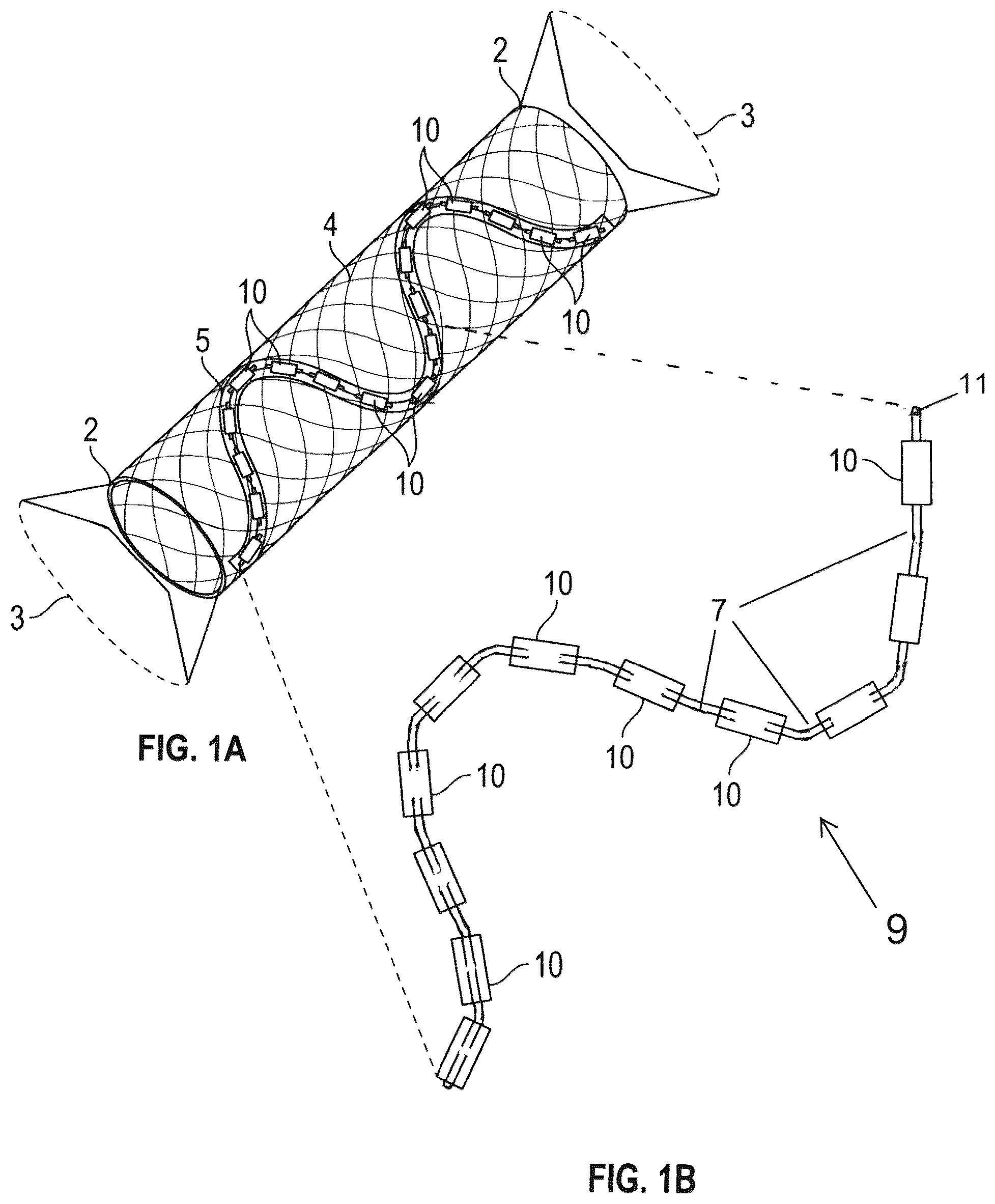 Patent US12350515 Figure 1 – Variable volume brachytherapy stent, method for delivering variable dosimetries in brachytherapy