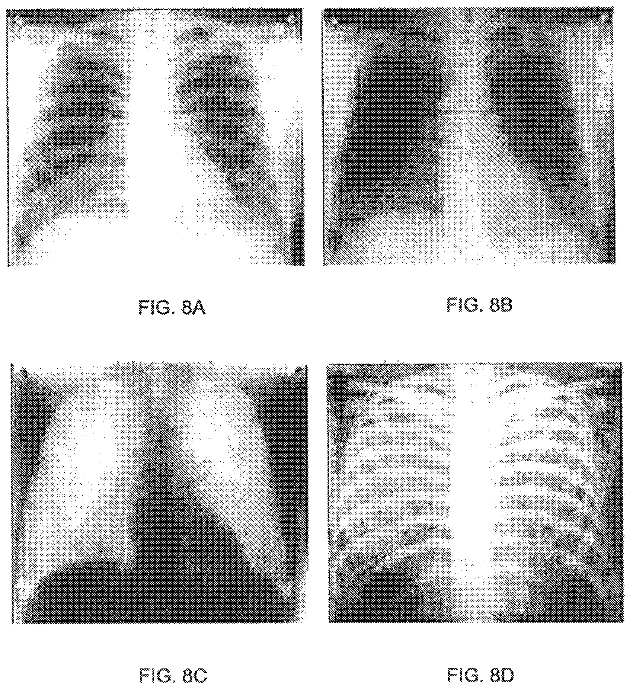 Patent US12350517 Figure 8 – Image-guided radiation treatment with imaging data using imaging radiation at different energy levels