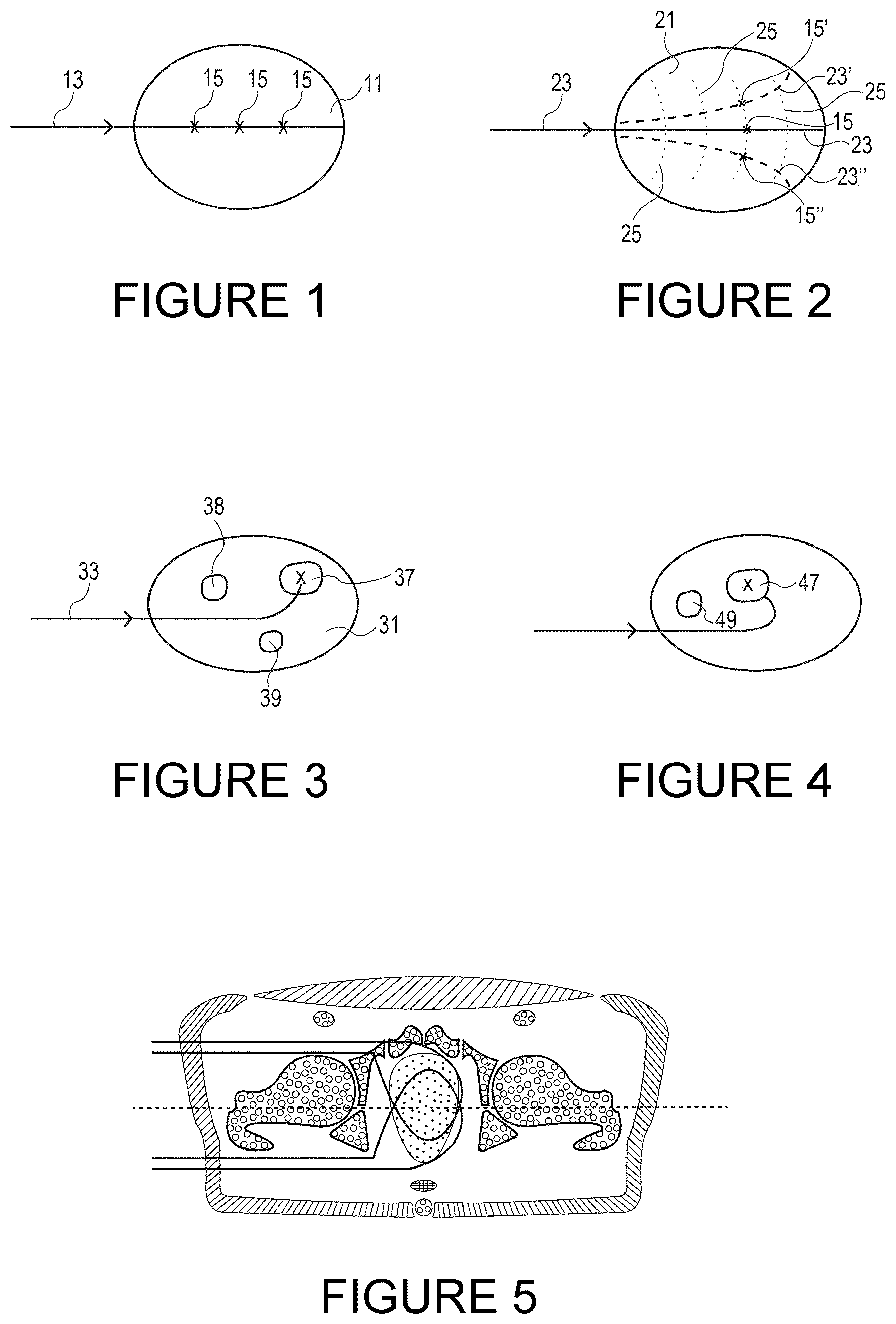 Patent US12350521 Figure 1 – Computer program product and computer system for planning and delivering radiotherapy treatment and a method of planning radiotherapy treatment
