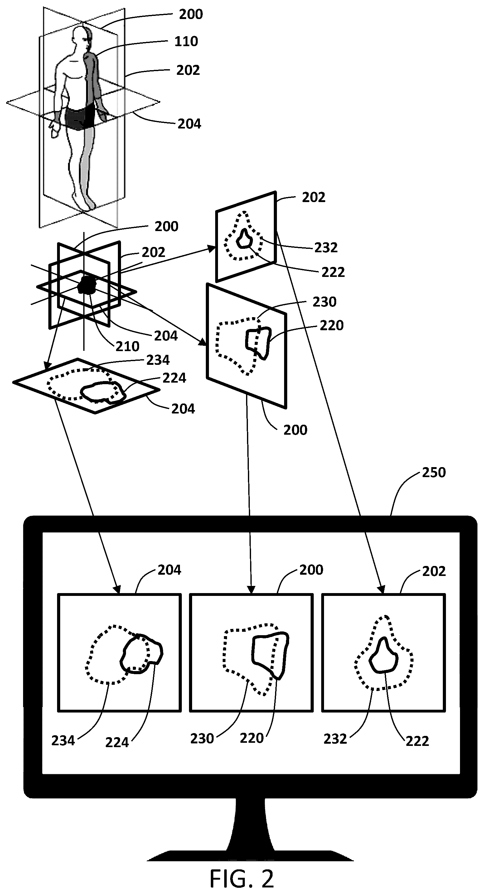 Patent US12350523 Figure 2 – MRI guided radiotherapy