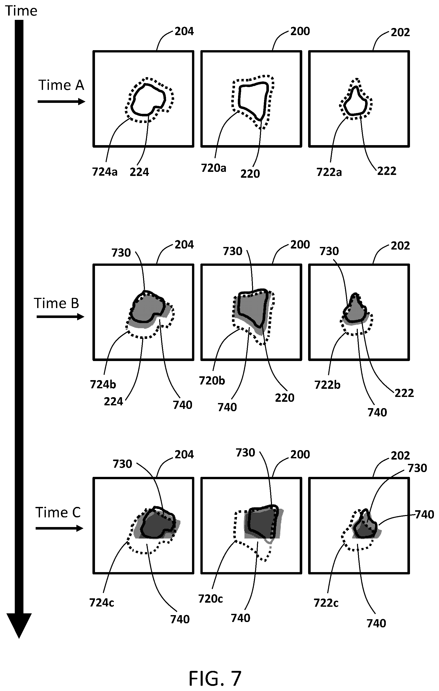 Patent US12350523 Figure 7 – MRI guided radiotherapy