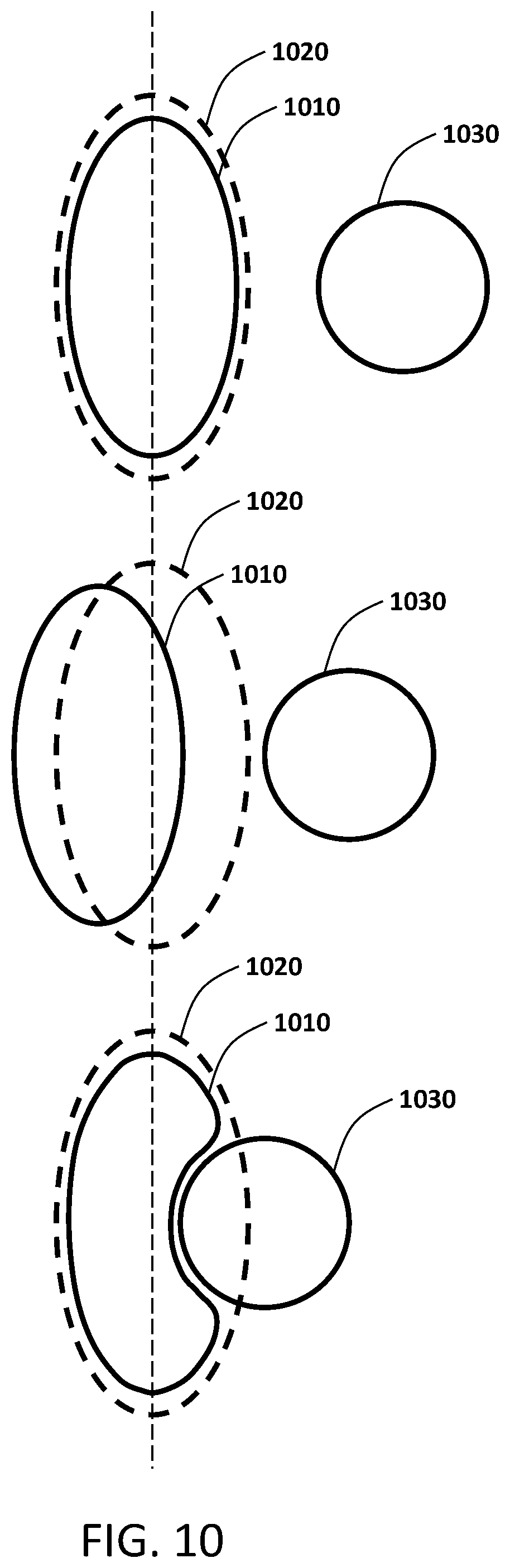Patent US12350523 Figure 10 – MRI guided radiotherapy