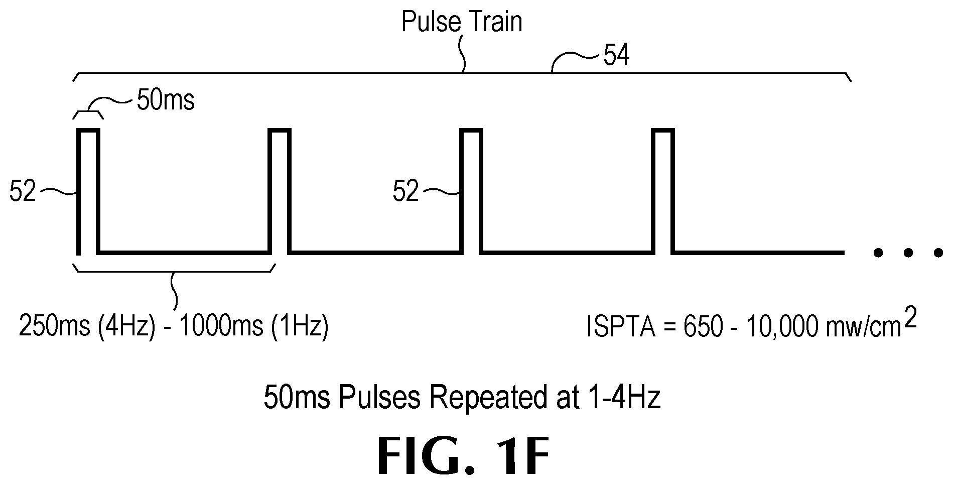 Patent US12350524 Figure 6 – Treating degenerative dementia with low intensity focused ultrasound pulsation (LIFUP) device