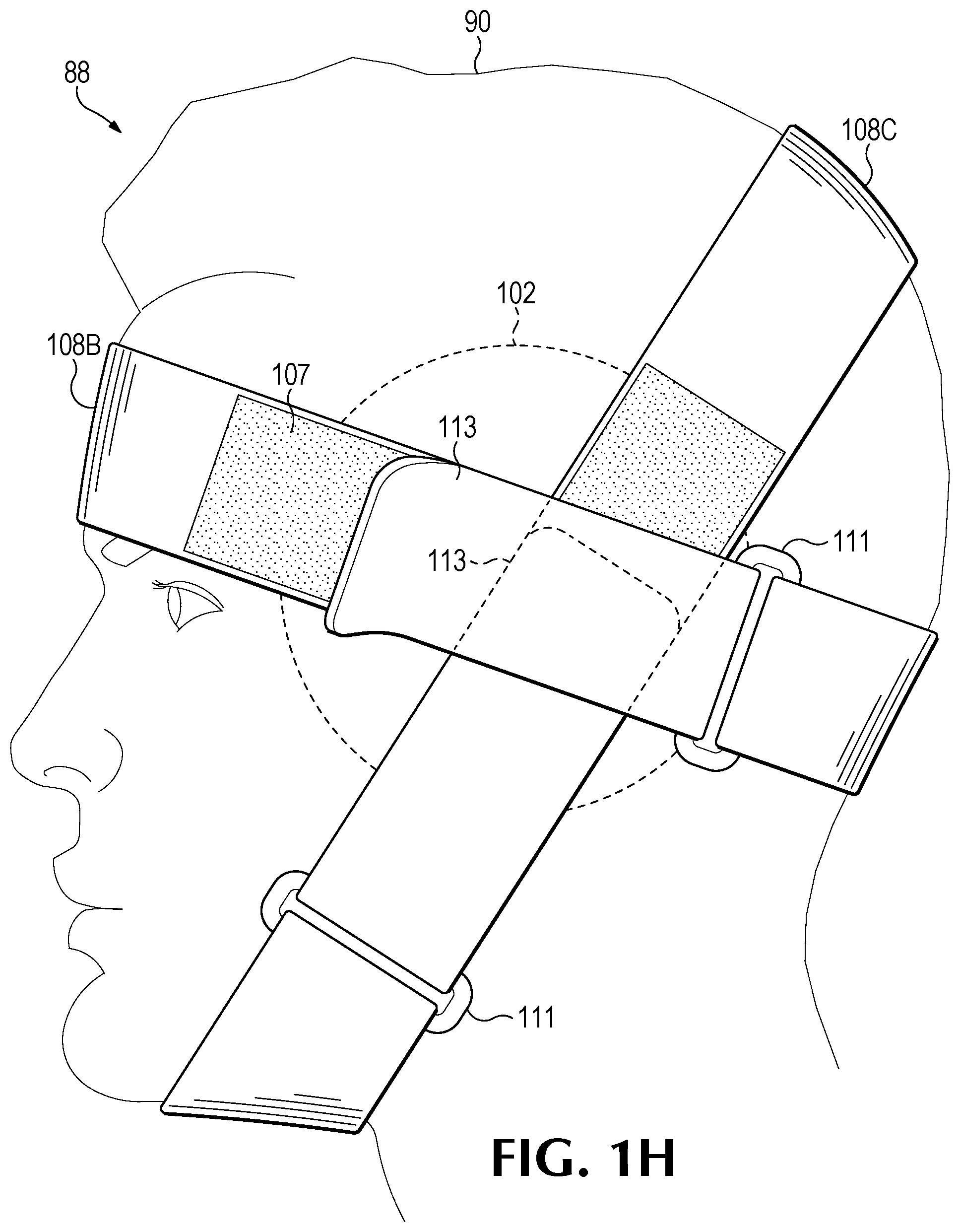 Patent US12350524 Figure 8 – Treating degenerative dementia with low intensity focused ultrasound pulsation (LIFUP) device