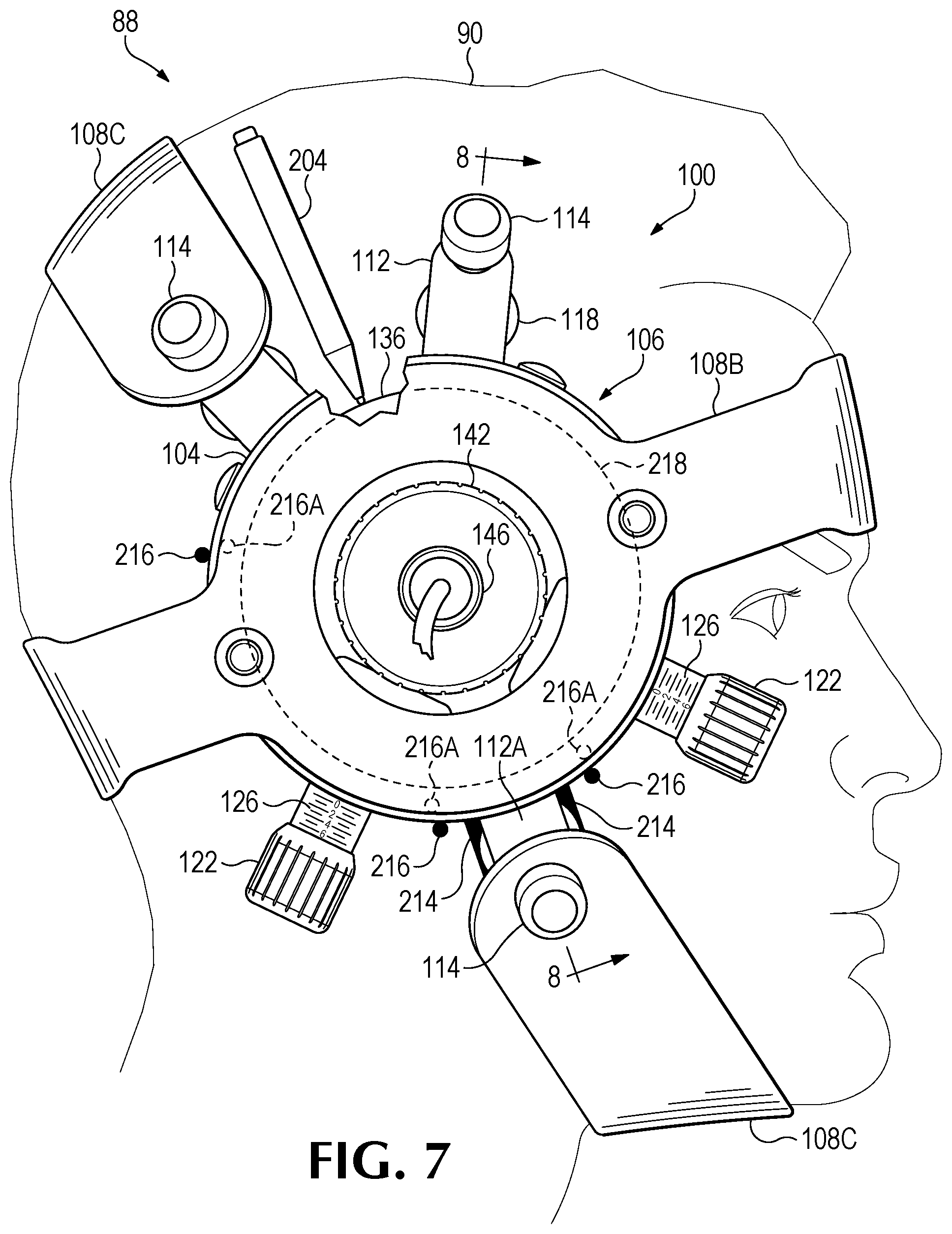 Patent US12350524 Figure 14 – Treating degenerative dementia with low intensity focused ultrasound pulsation (LIFUP) device