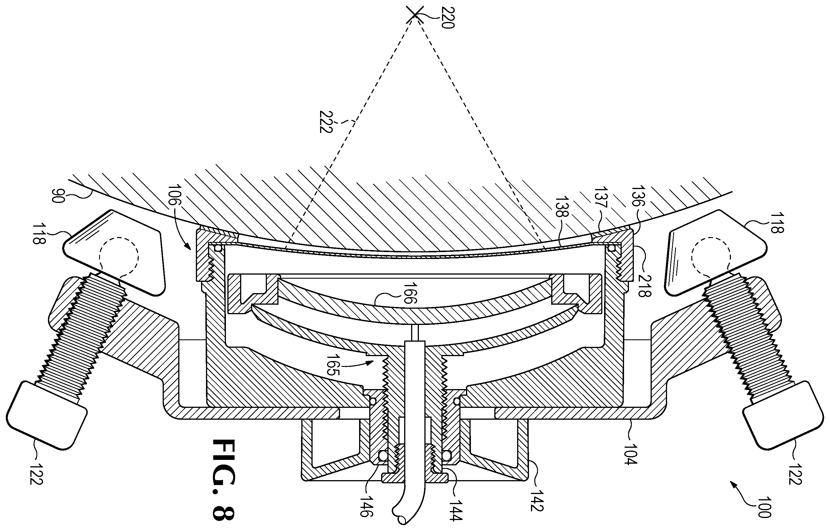 Patent US12350524 Figure 15 – Treating degenerative dementia with low intensity focused ultrasound pulsation (LIFUP) device
