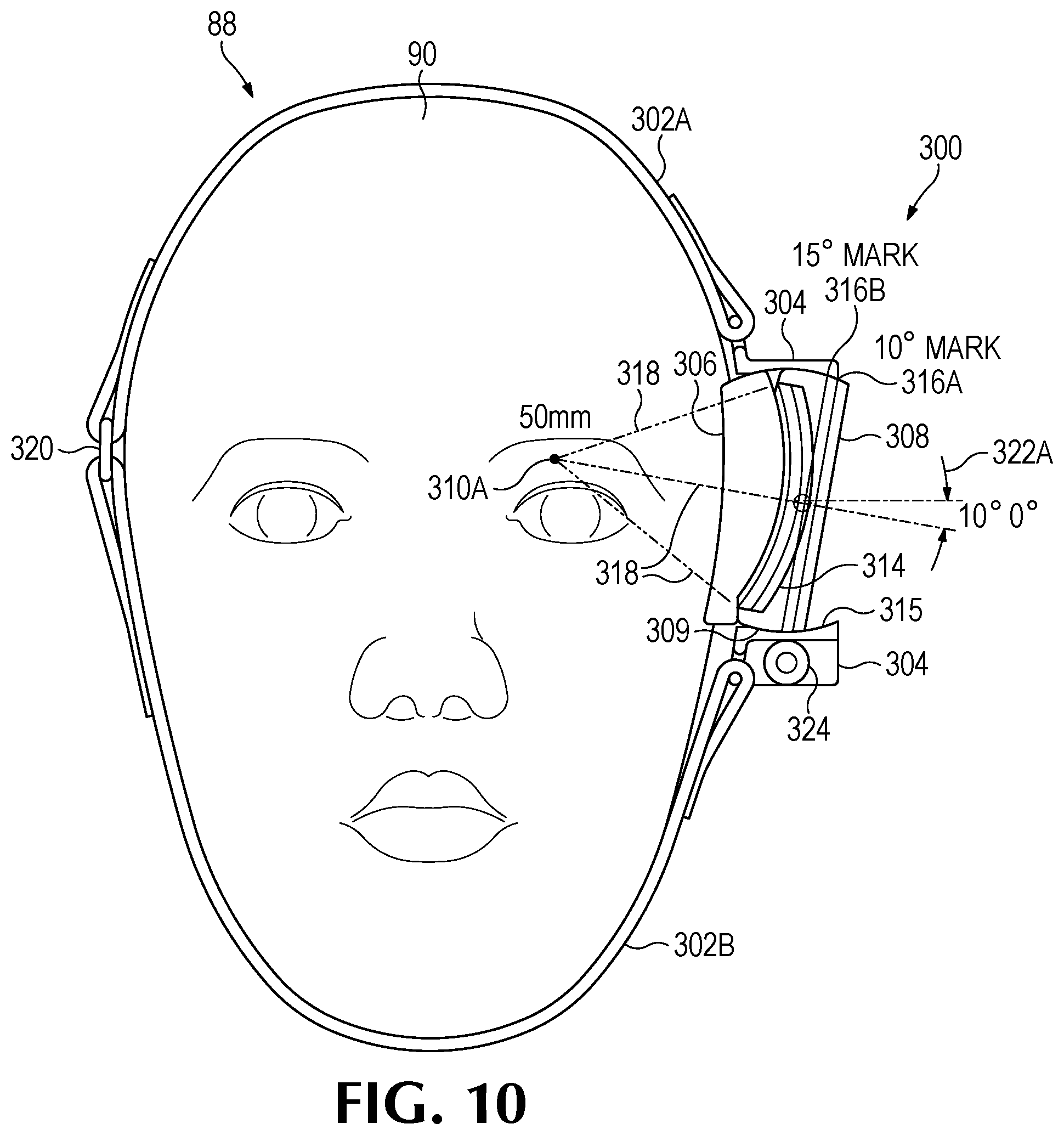 Patent US12350524 Figure 17 – Treating degenerative dementia with low intensity focused ultrasound pulsation (LIFUP) device
