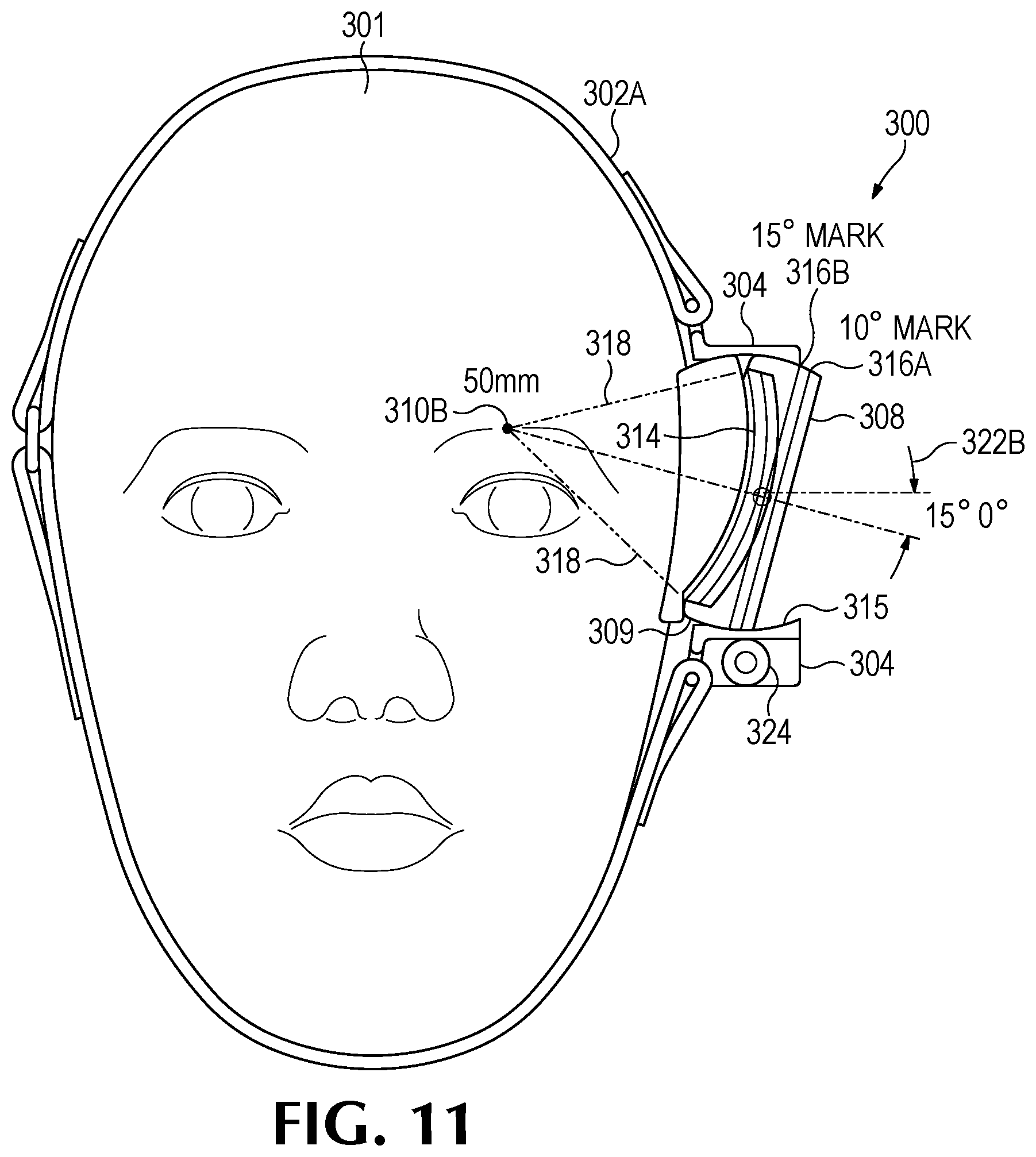 Patent US12350524 Figure 18 – Treating degenerative dementia with low intensity focused ultrasound pulsation (LIFUP) device