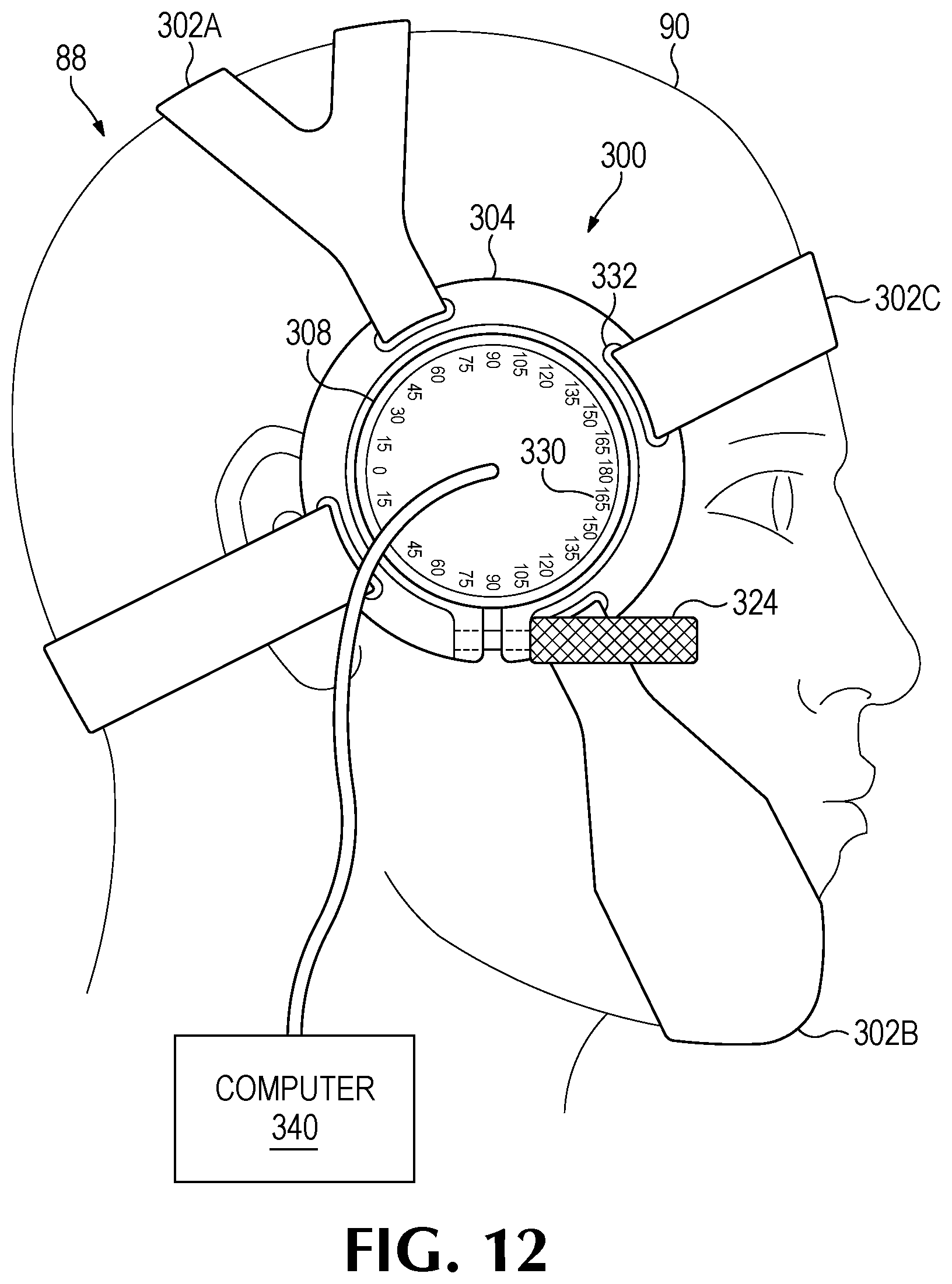 Patent US12350524 Figure 19 – Treating degenerative dementia with low intensity focused ultrasound pulsation (LIFUP) device