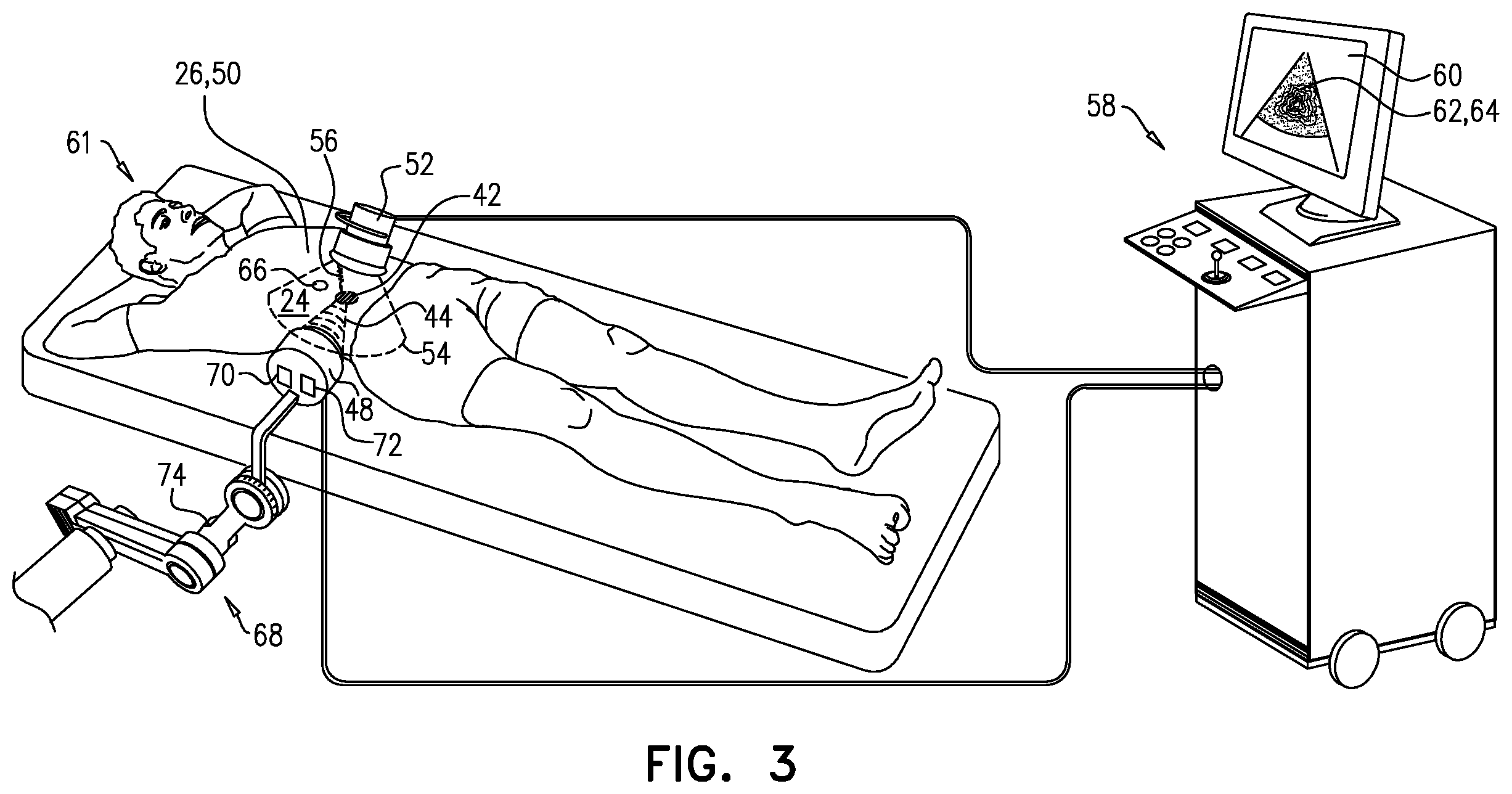 Patent US12350526 Figure 3 – Doppler guided ultrasound therapy