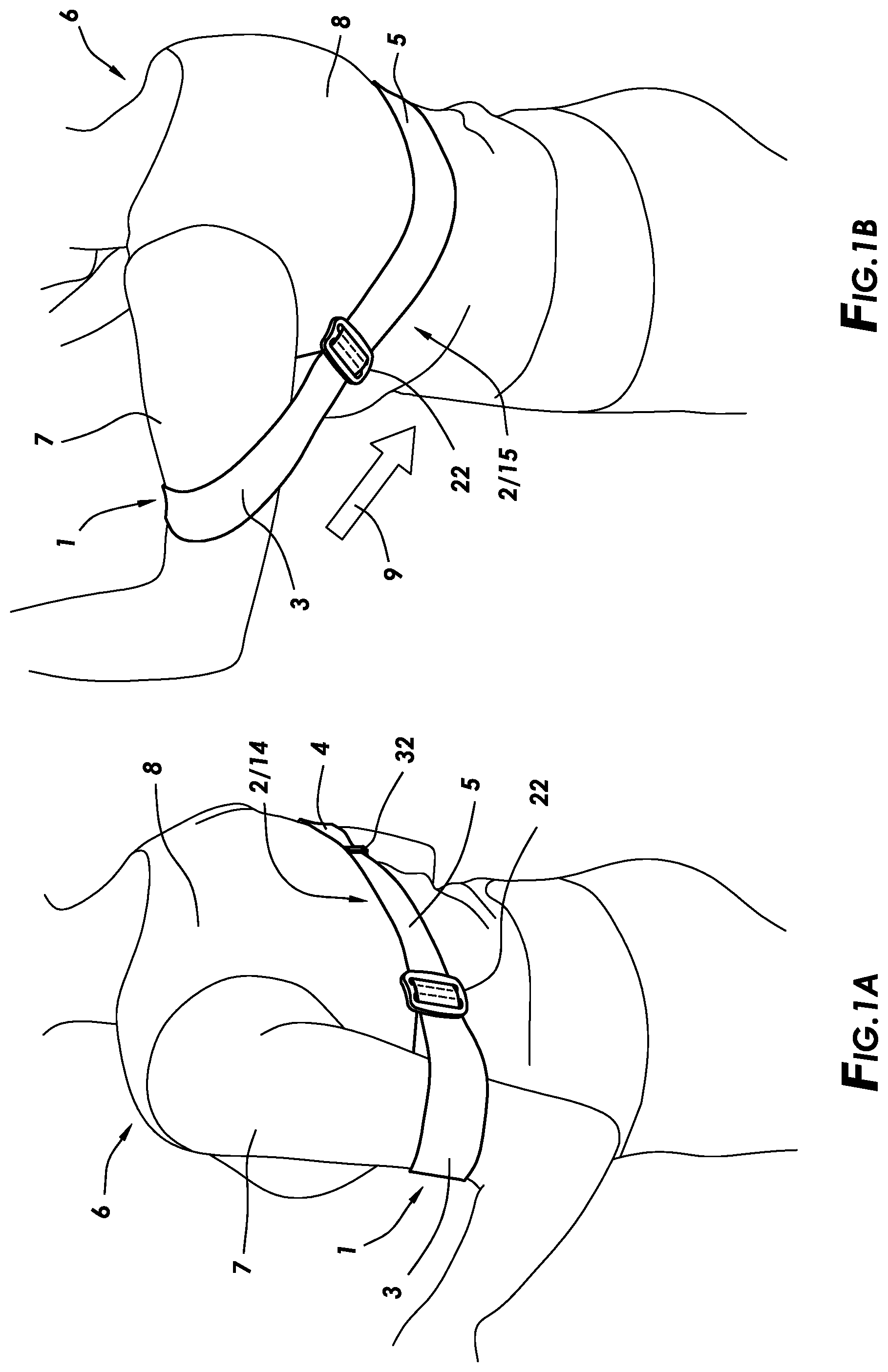 Patent US12350536 Figure 1 – Arm-training device