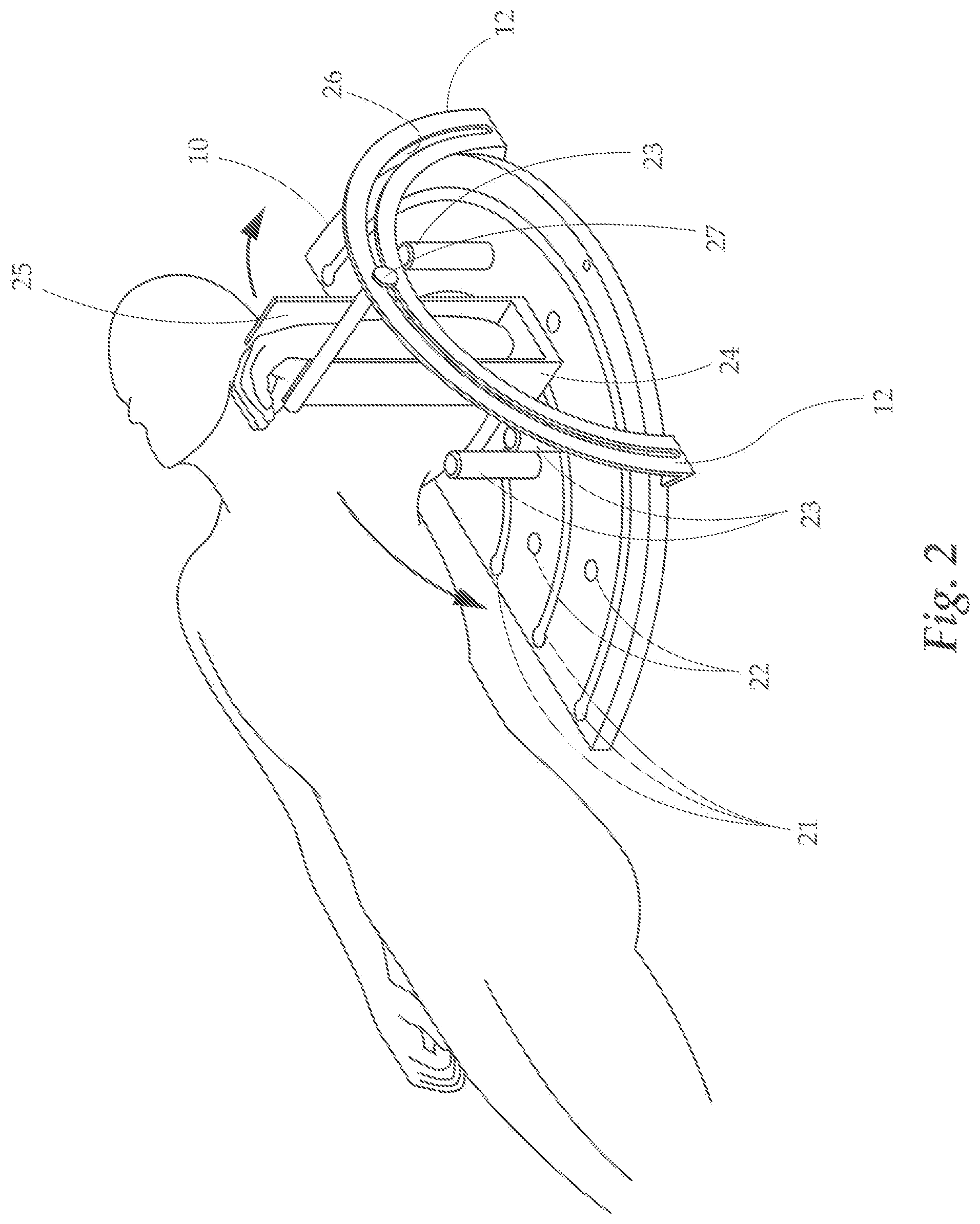 Patent US12350549 Figure 2 – Training and rehabilitation device