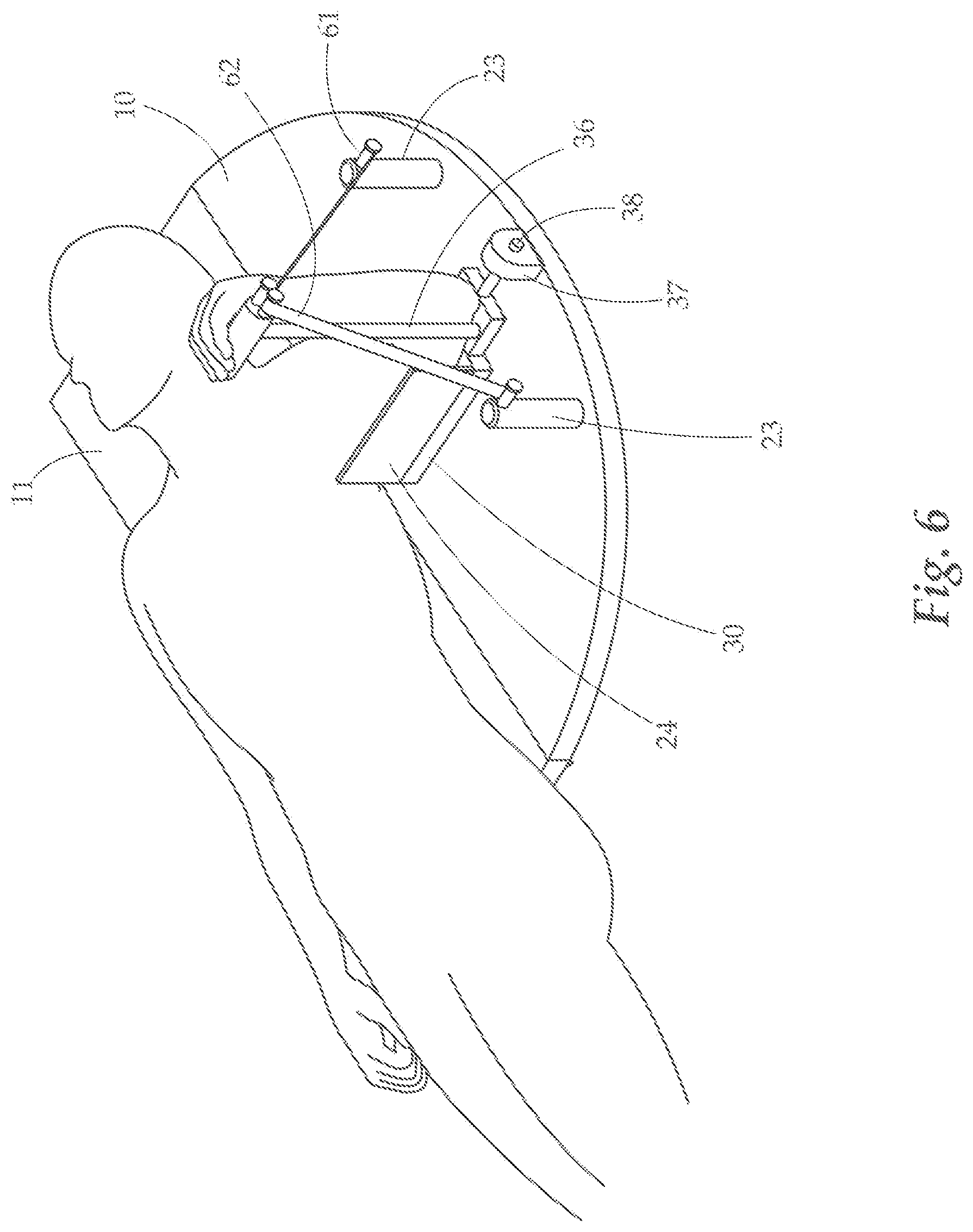 Patent US12350549 Figure 6 – Training and rehabilitation device