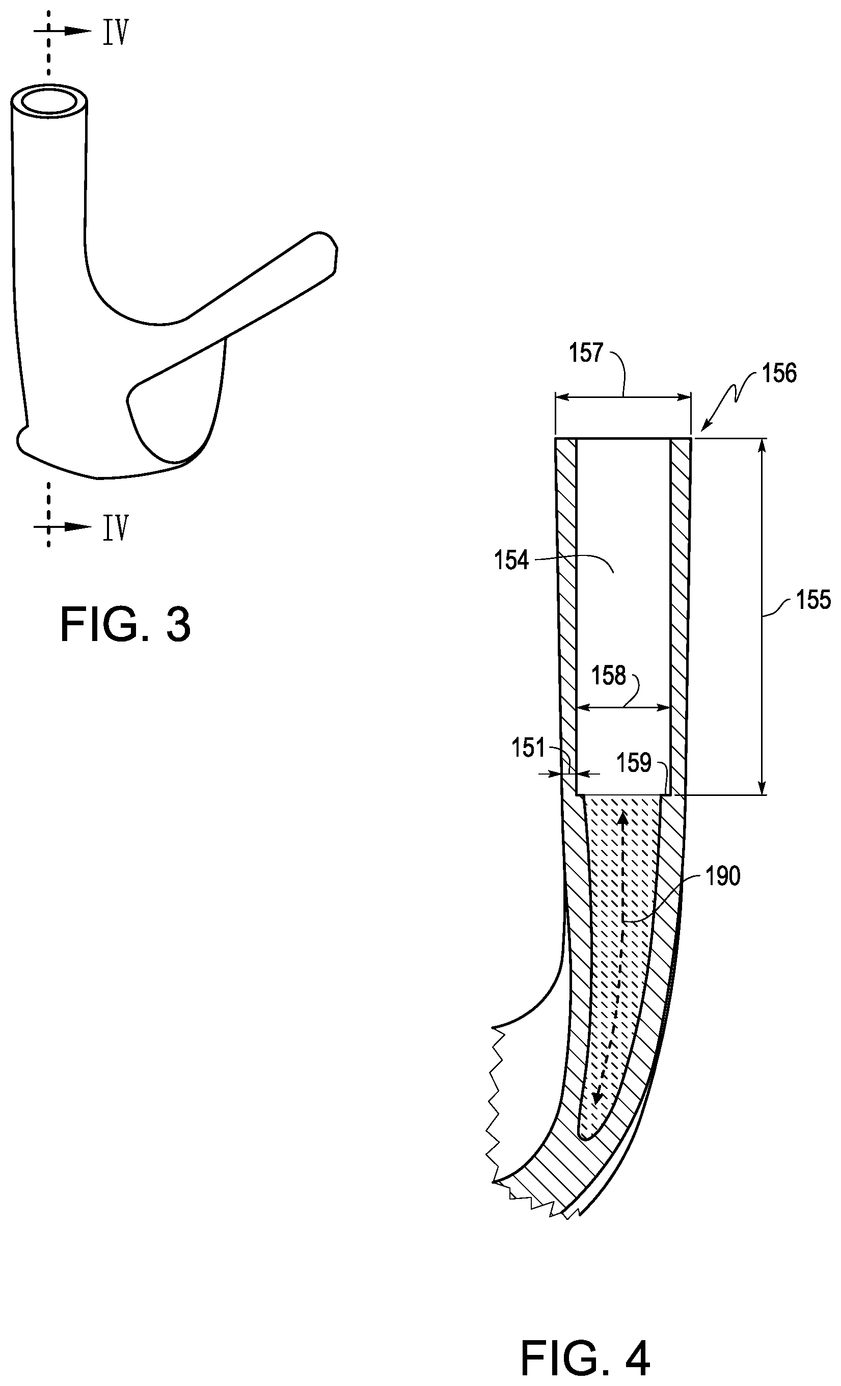 Patent US12350557 Figure 2 – Golf club head
