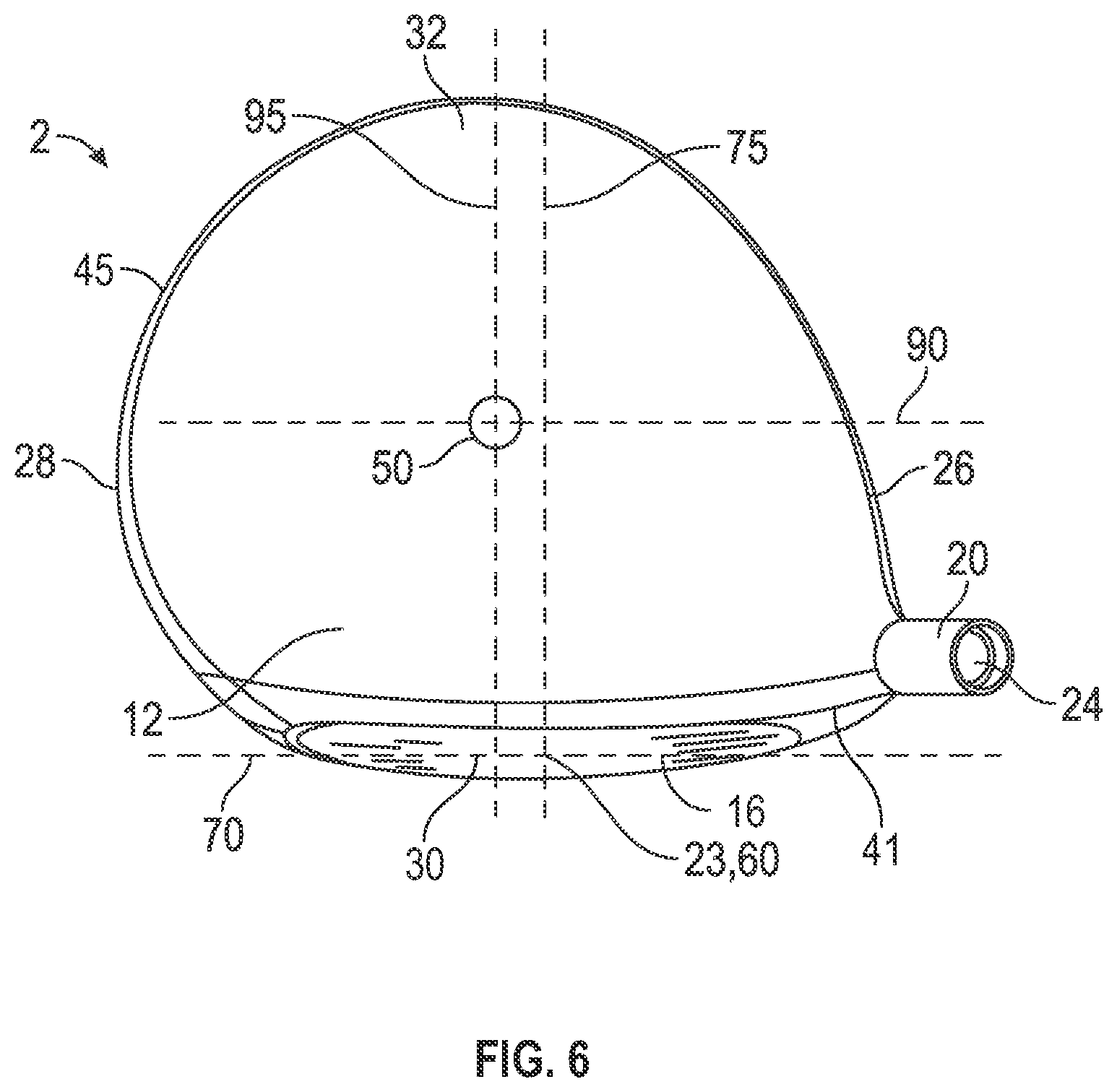 Patent US12350558 Figure 3 – Golf clubs with electronic displays