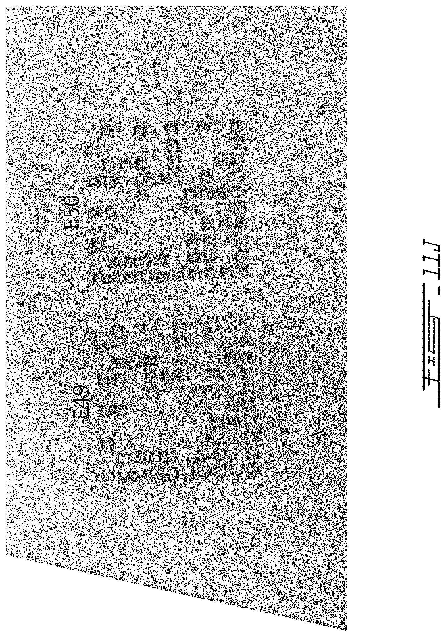 Patent US12350757 Figure 20 – Metal workpieces with shot blast resistant identifiers, methods and systems for laser-marking such identifiers