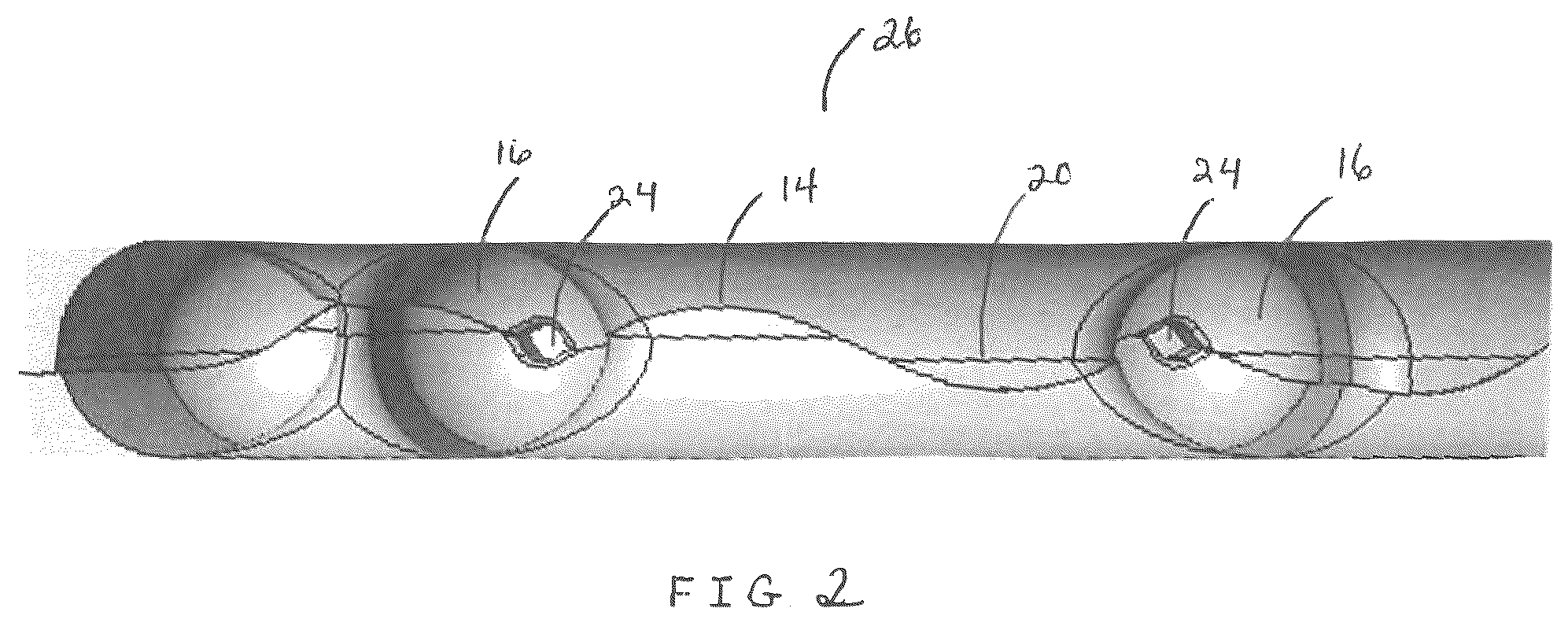 Patent US12350869 Figure 2 – Injection molding method and mold