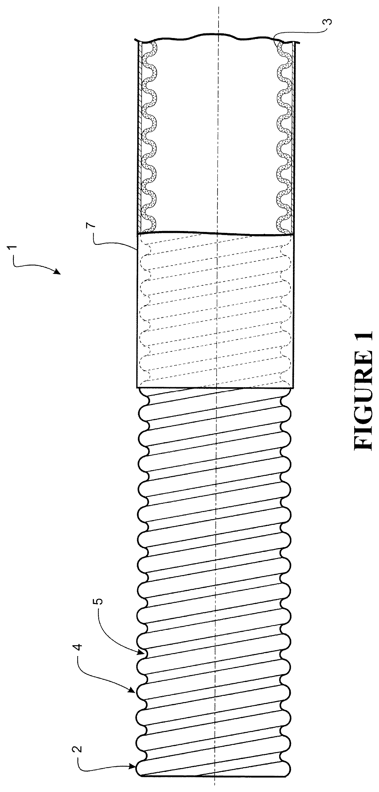 Patent US12350874 Figure 1 – Component for conveying gases