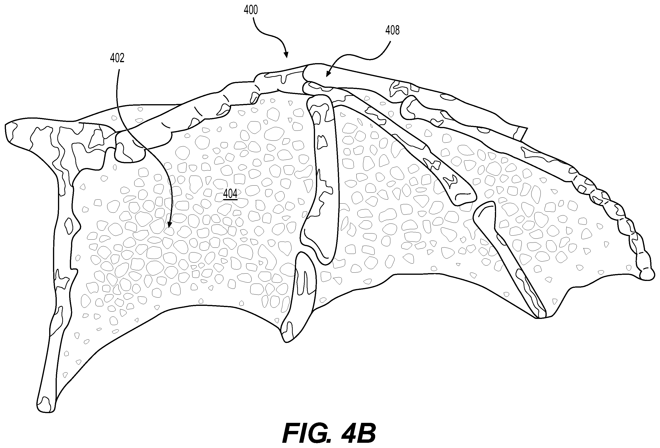 Patent US12350889 Figure 6 – 3D axial growth object, and apparatus for and method of making thereof