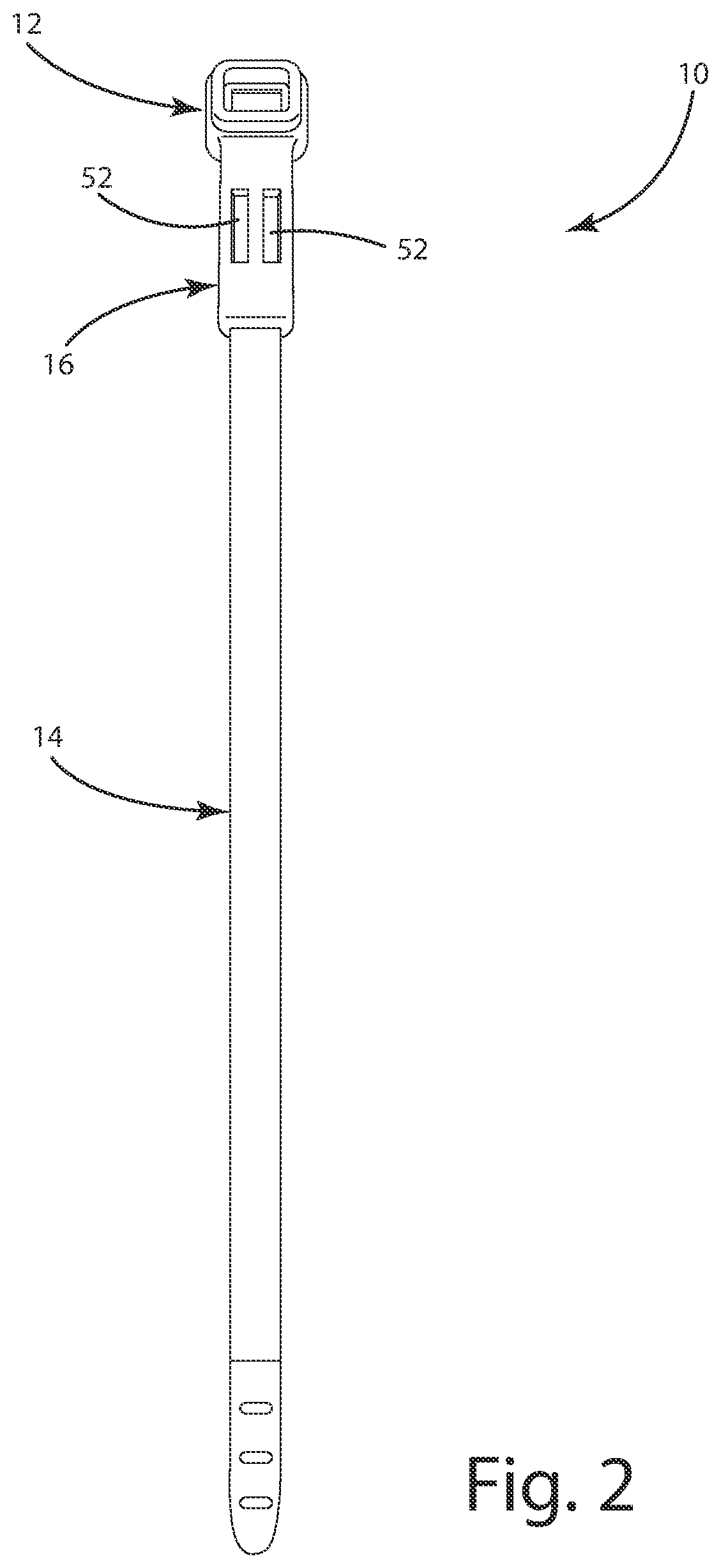 Patent US12351375 Figure 2 – Ligation assembly and method for using the same