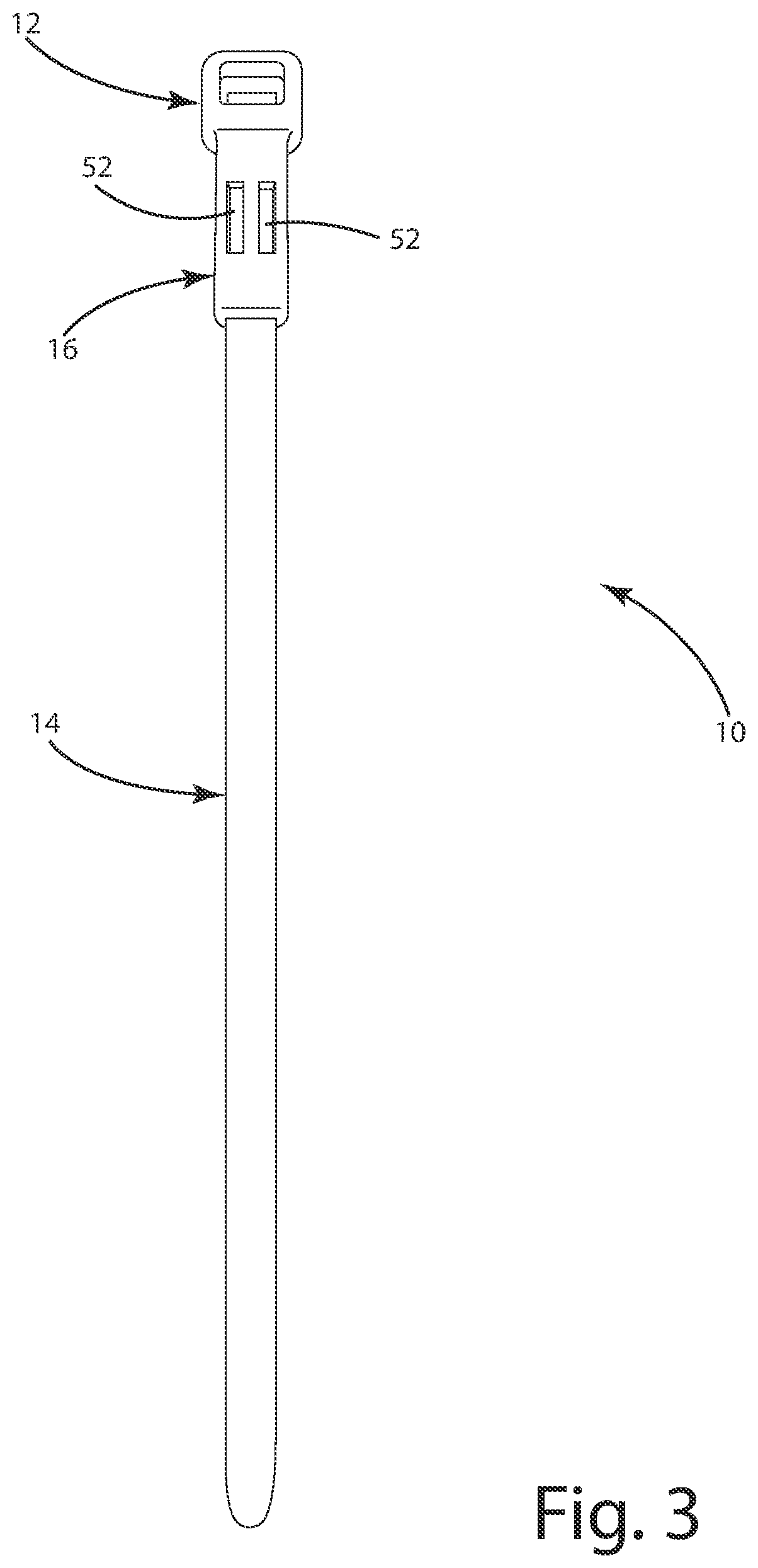 Patent US12351375 Figure 3 – Ligation assembly and method for using the same