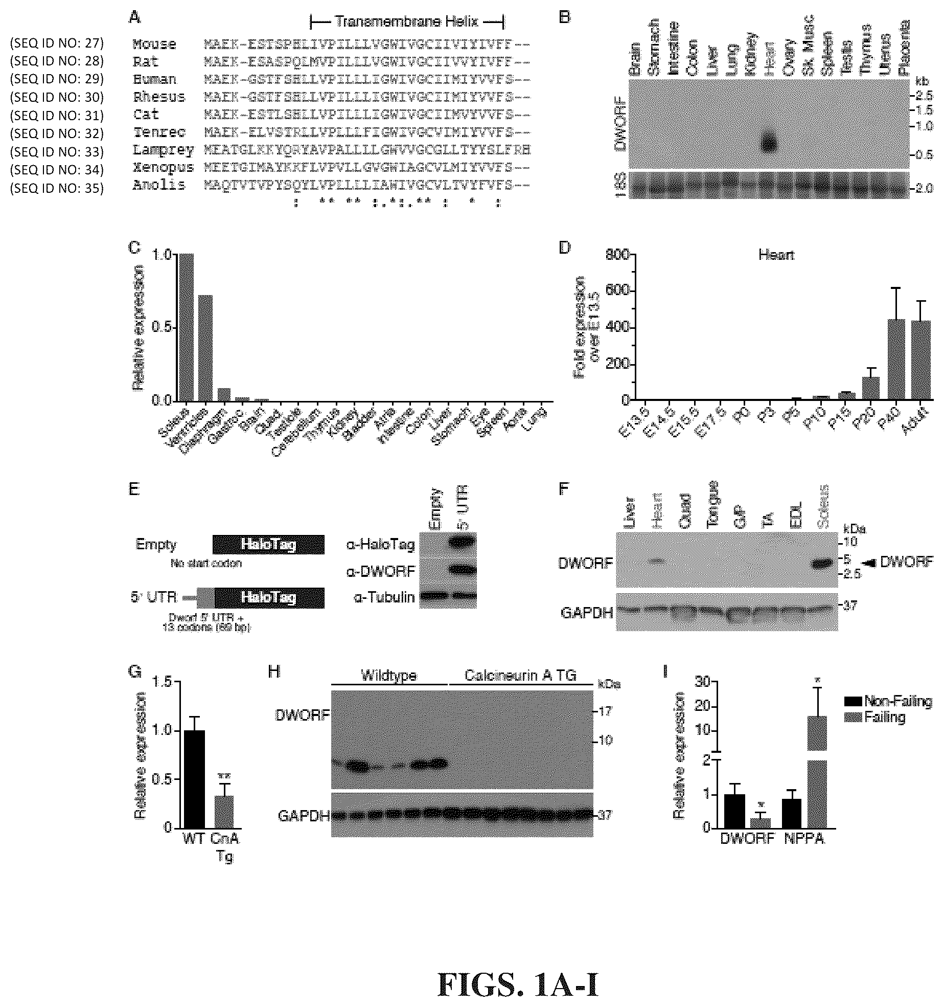 Patent US12351609 Figure 1 – Use of a small native peptide activator of SERCA pump for treatment of heart failure and other disorders characterized by cytosolic calcium overload