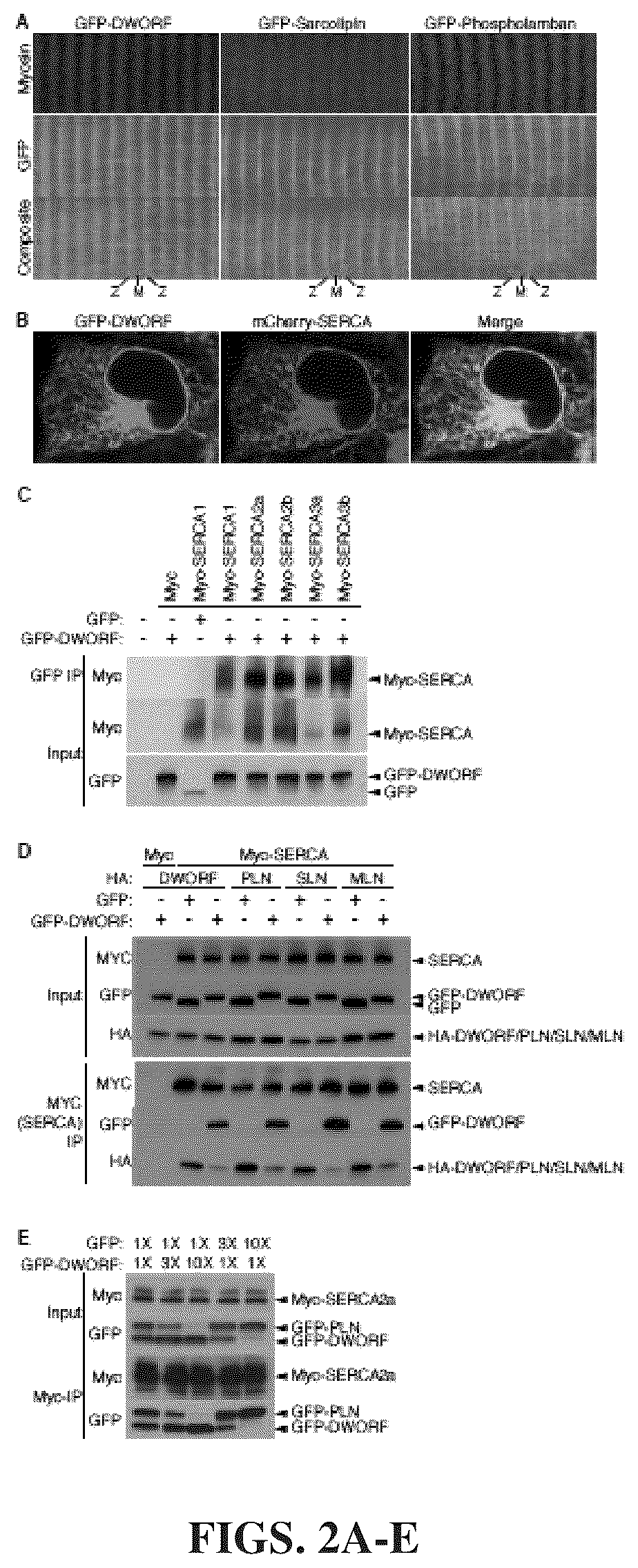 Patent US12351609 Figure 2 – Use of a small native peptide activator of SERCA pump for treatment of heart failure and other disorders characterized by cytosolic calcium overload