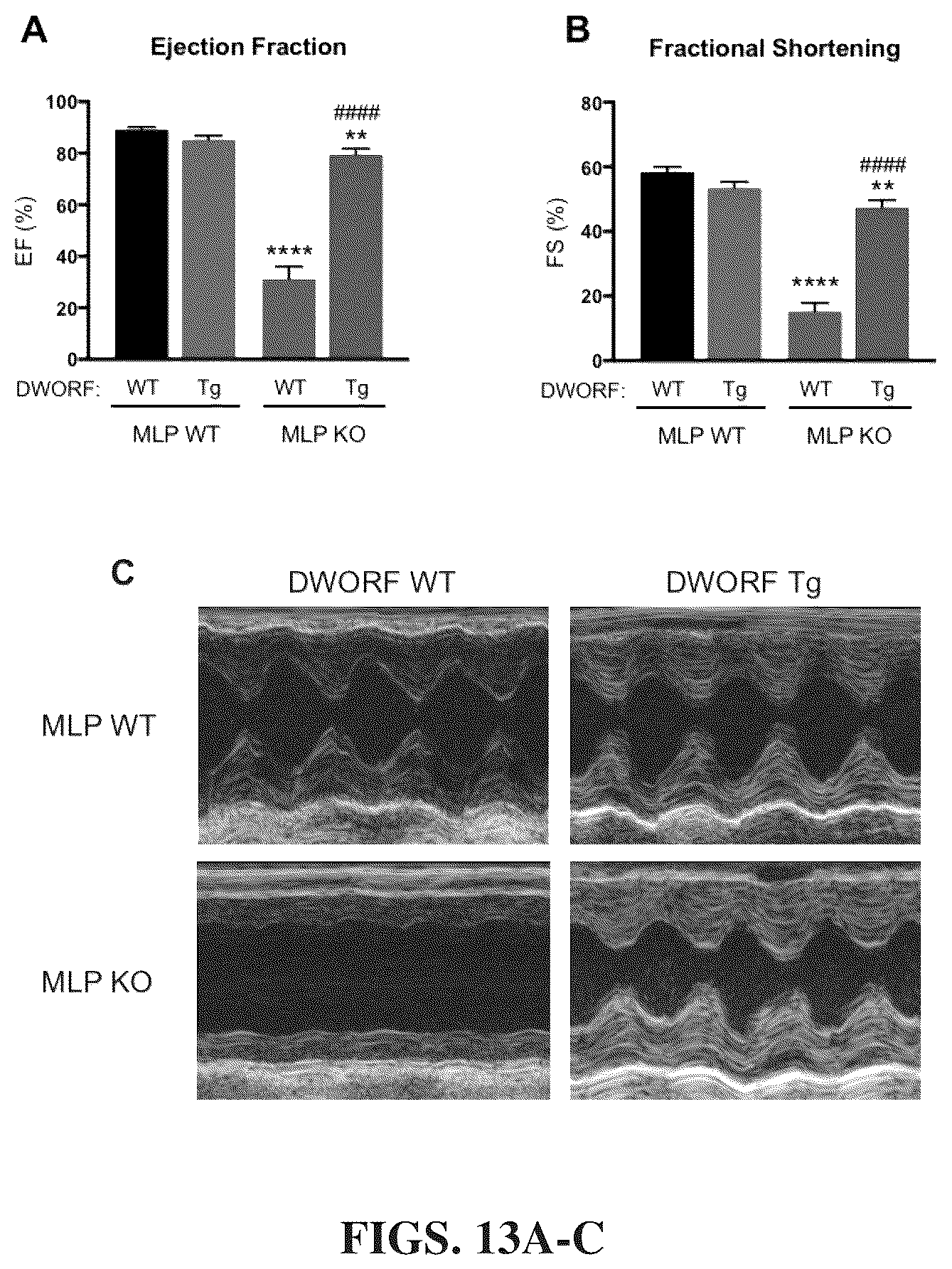 Patent US12351609 Figure 12 – Use of a small native peptide activator of SERCA pump for treatment of heart failure and other disorders characterized by cytosolic calcium overload