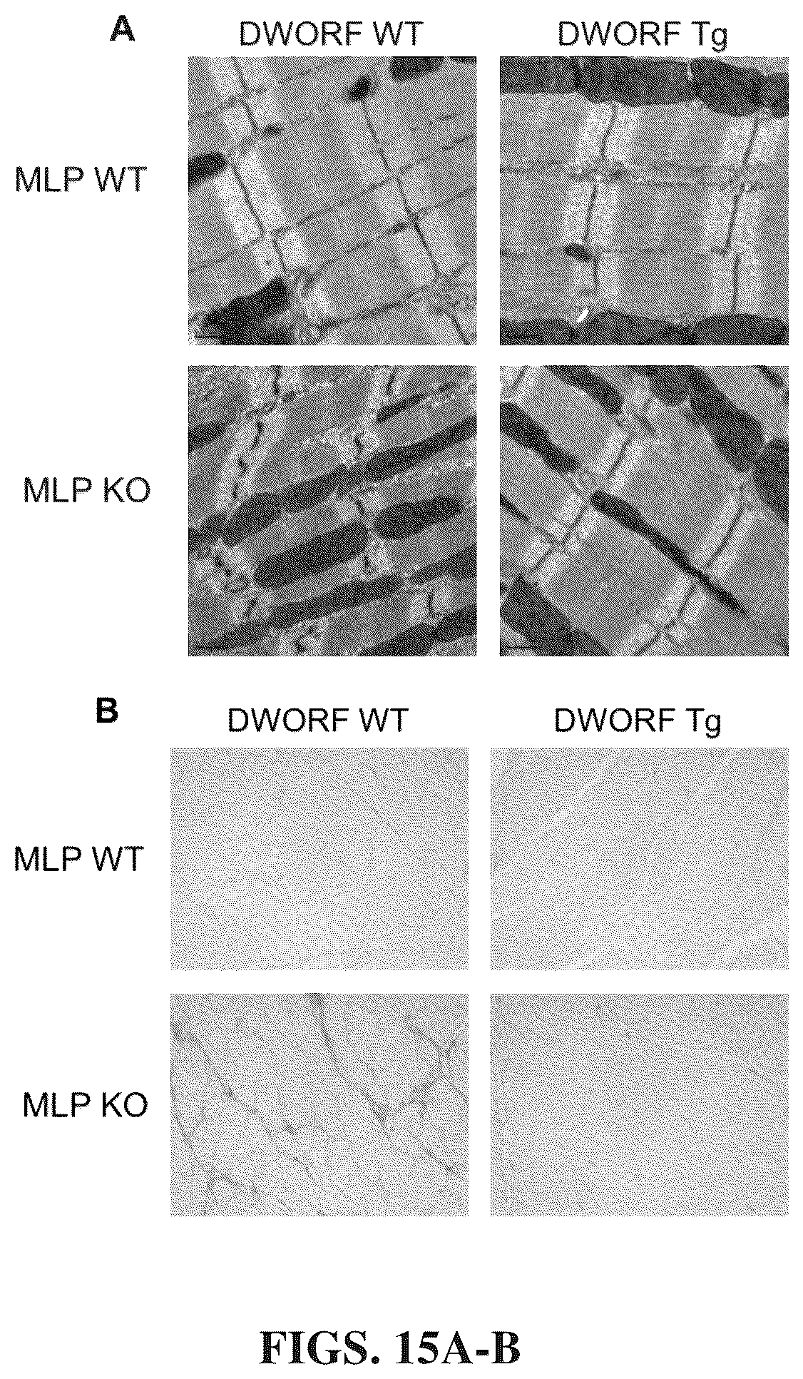 Patent US12351609 Figure 14 – Use of a small native peptide activator of SERCA pump for treatment of heart failure and other disorders characterized by cytosolic calcium overload