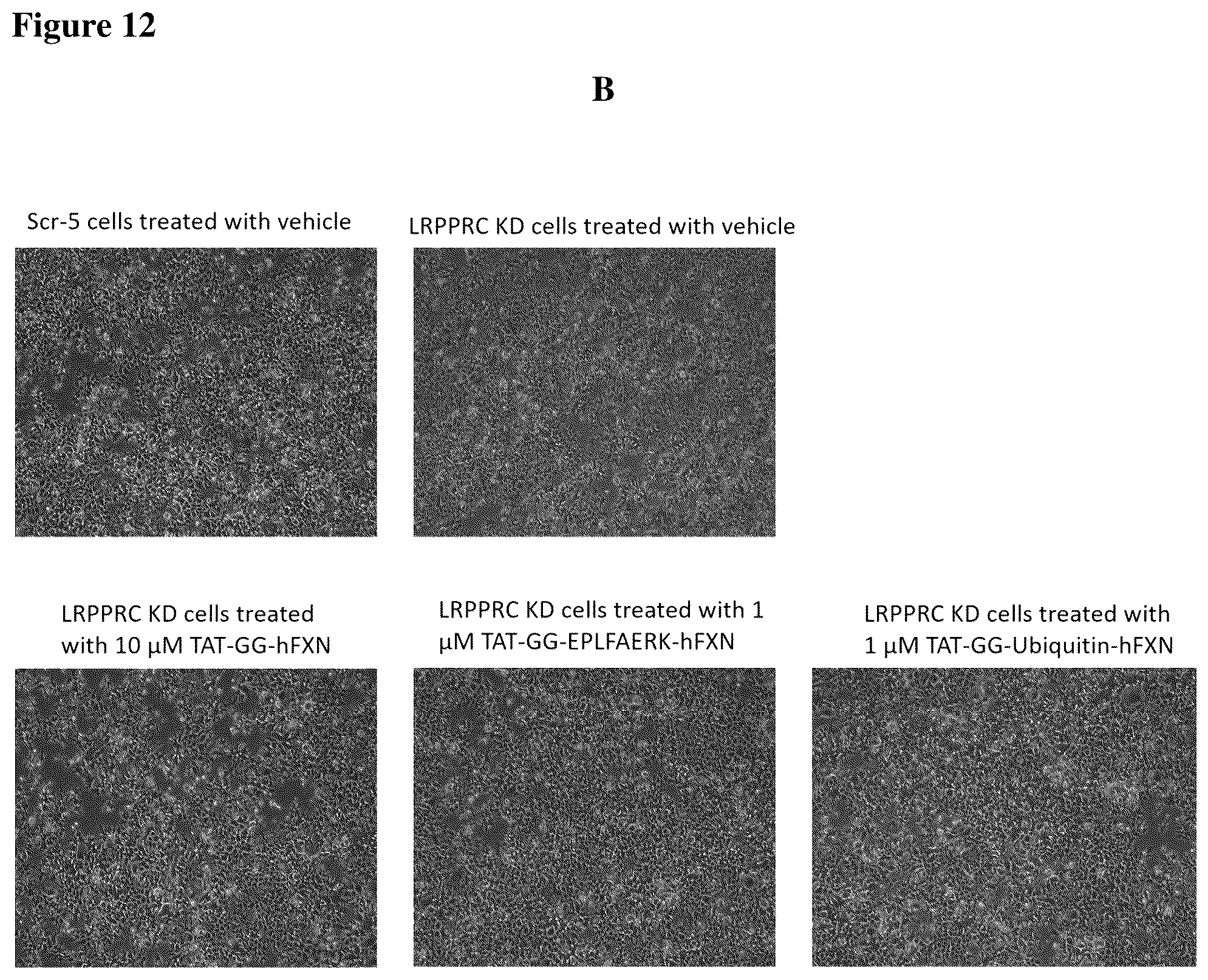 Patent US12351611 Figure 20 – Molecules for organelle-specific protein delivery