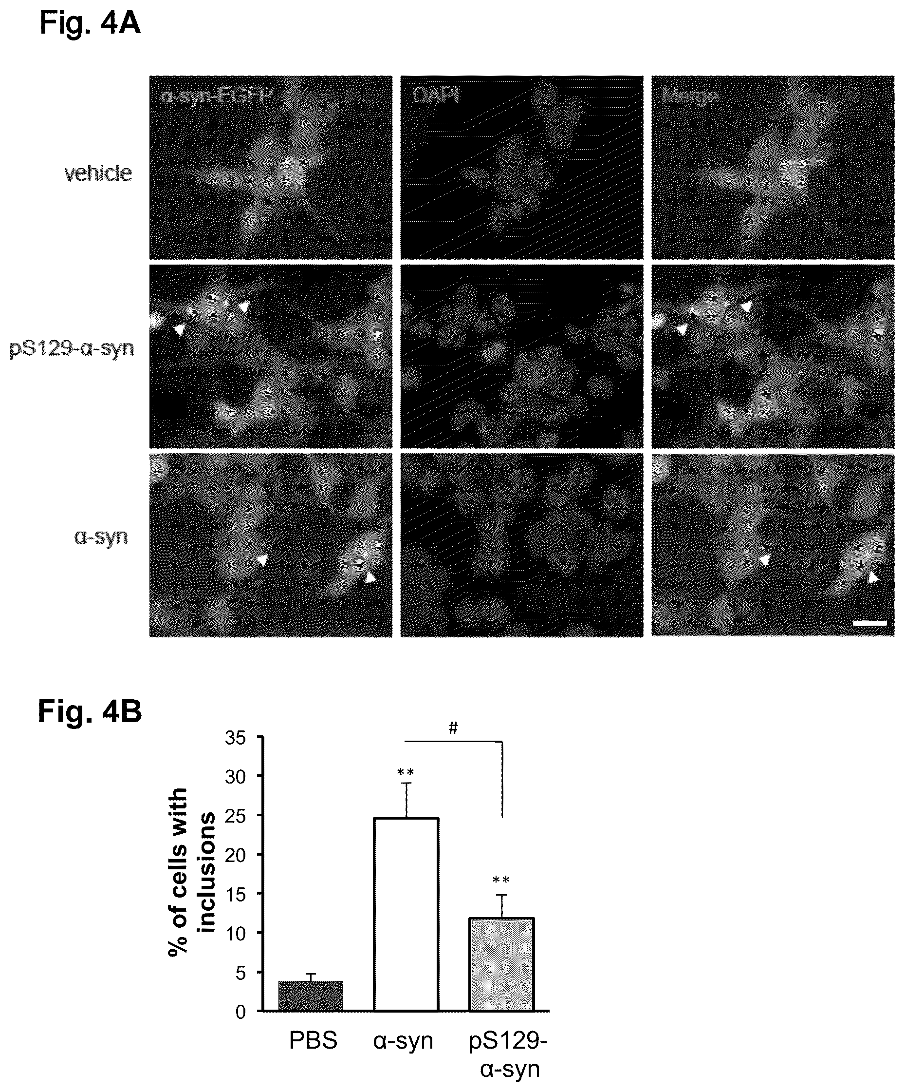 Patent US12351623 Figure 4 – Antibody compositions targeting non-phosphorylated alpha-synuclein aggregates