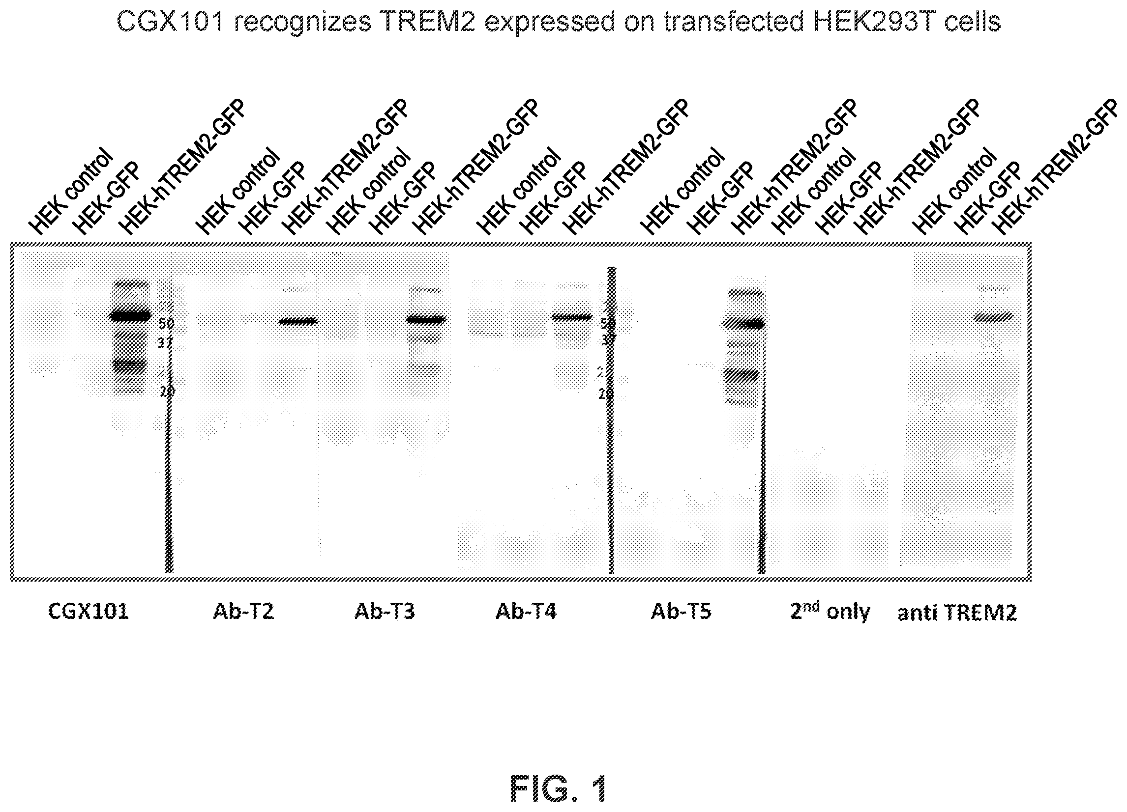Patent US12351629 Figure 1 – TREM2 antibodies and uses thereof