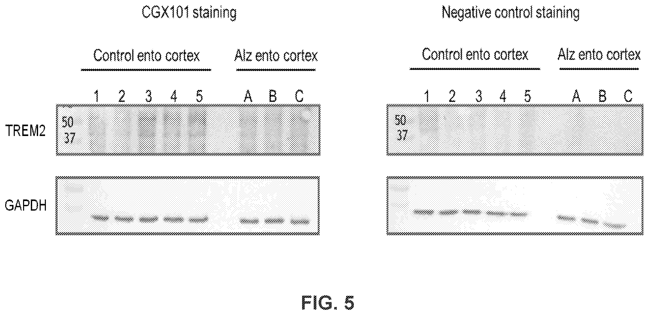 Patent US12351629 Figure 5 – TREM2 antibodies and uses thereof