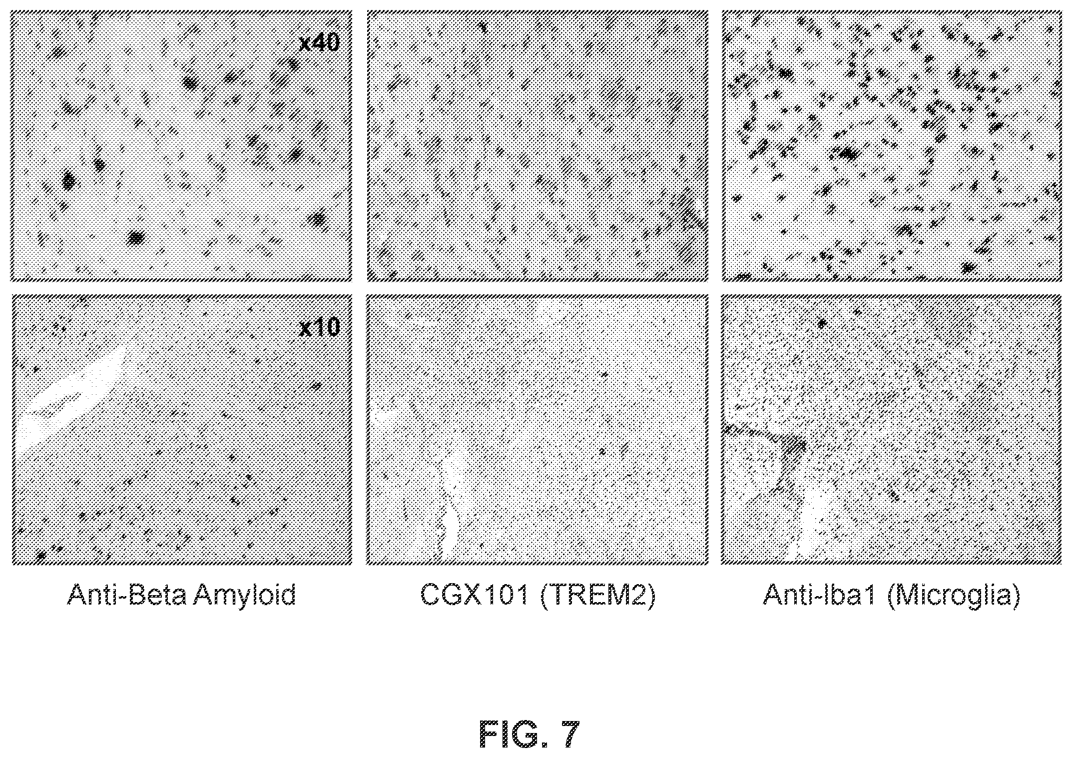 Patent US12351629 Figure 7 – TREM2 antibodies and uses thereof