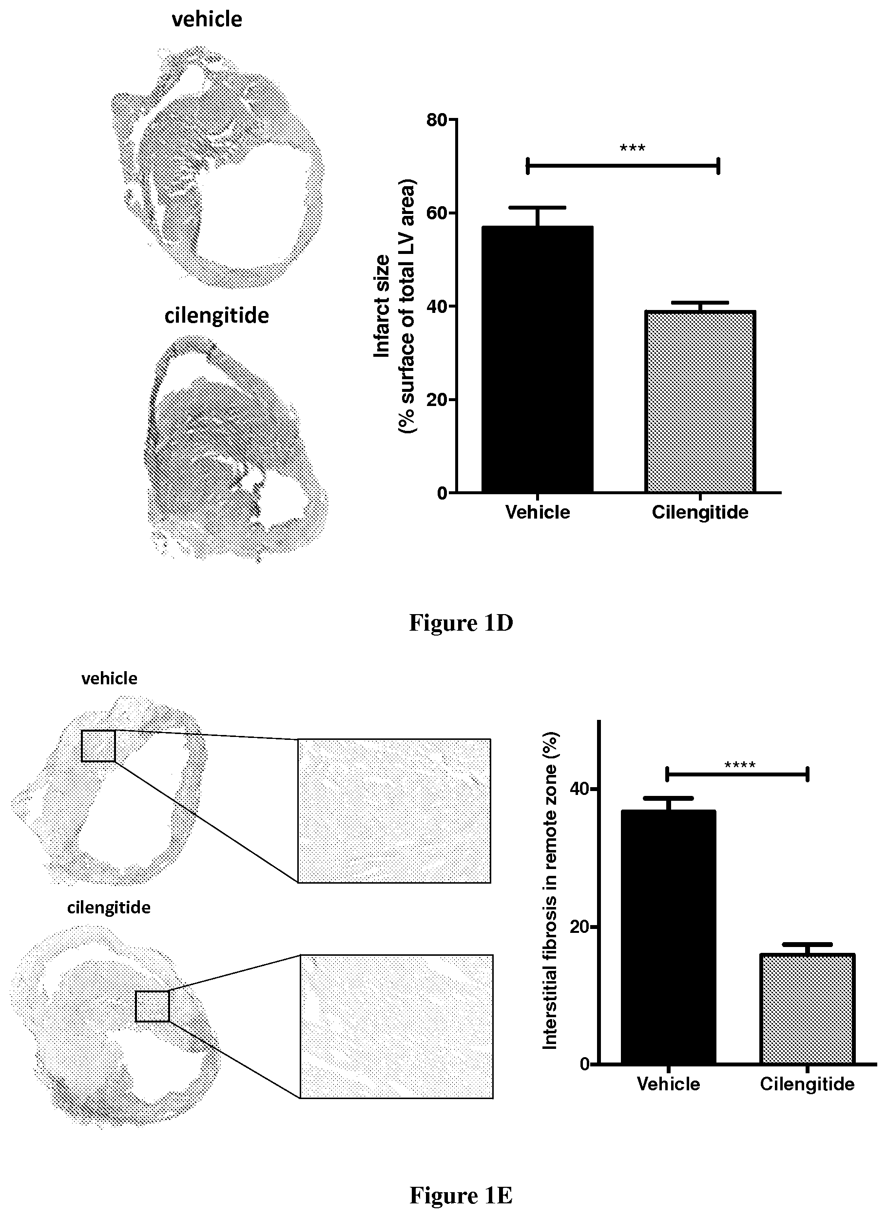 Patent US12351634 Figure 2 – Use of cilengitide for ameliorating cardiac fibrosis occurring in response to myocardial infarction