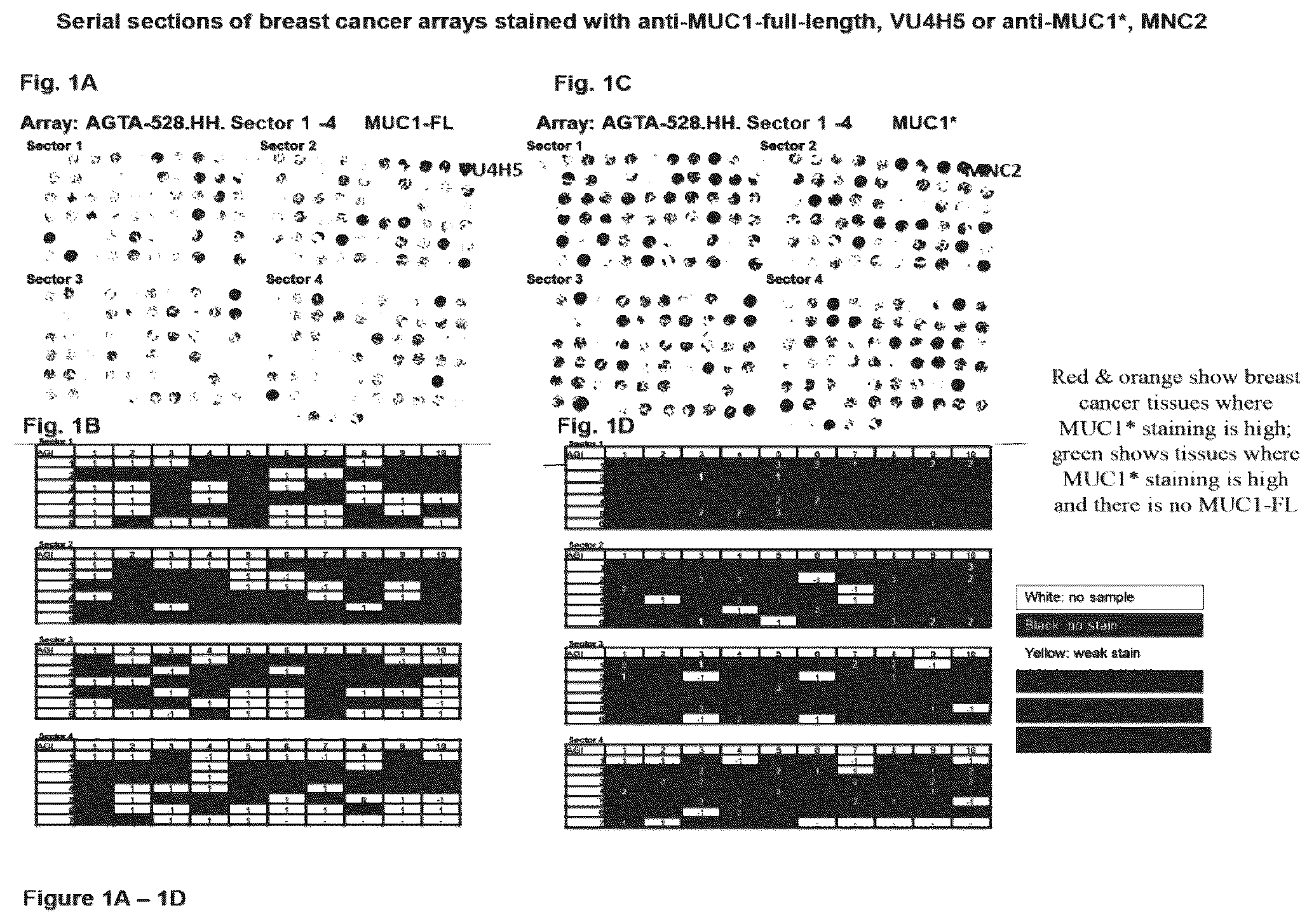 Patent US12351646 Figure 1 – Diagnostic methods using anti-MUC1* antibodies