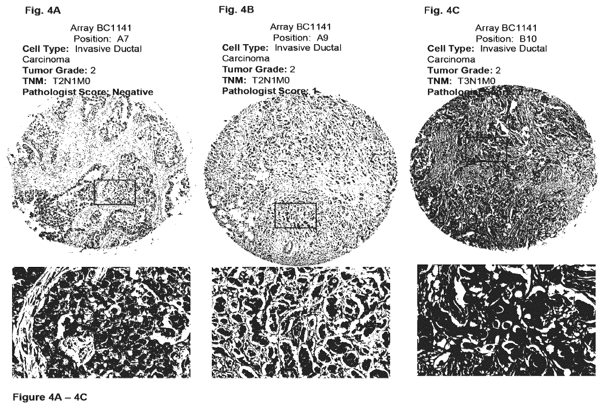 Patent US12351646 Figure 4 – Diagnostic methods using anti-MUC1* antibodies