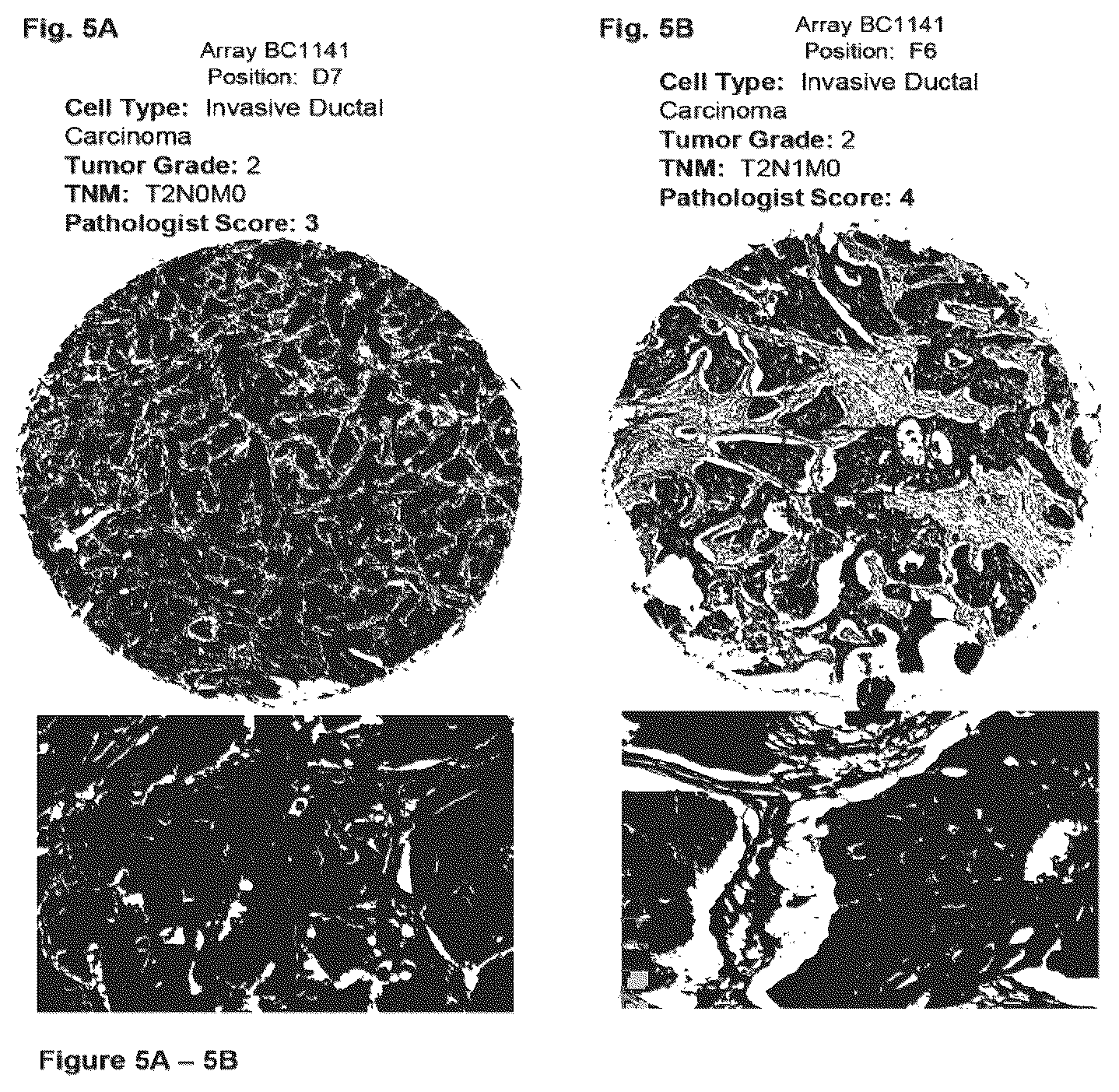 Patent US12351646 Figure 5 – Diagnostic methods using anti-MUC1* antibodies