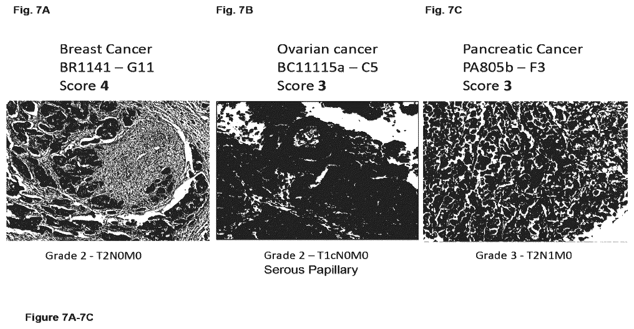 Patent US12351646 Figure 7 – Diagnostic methods using anti-MUC1* antibodies