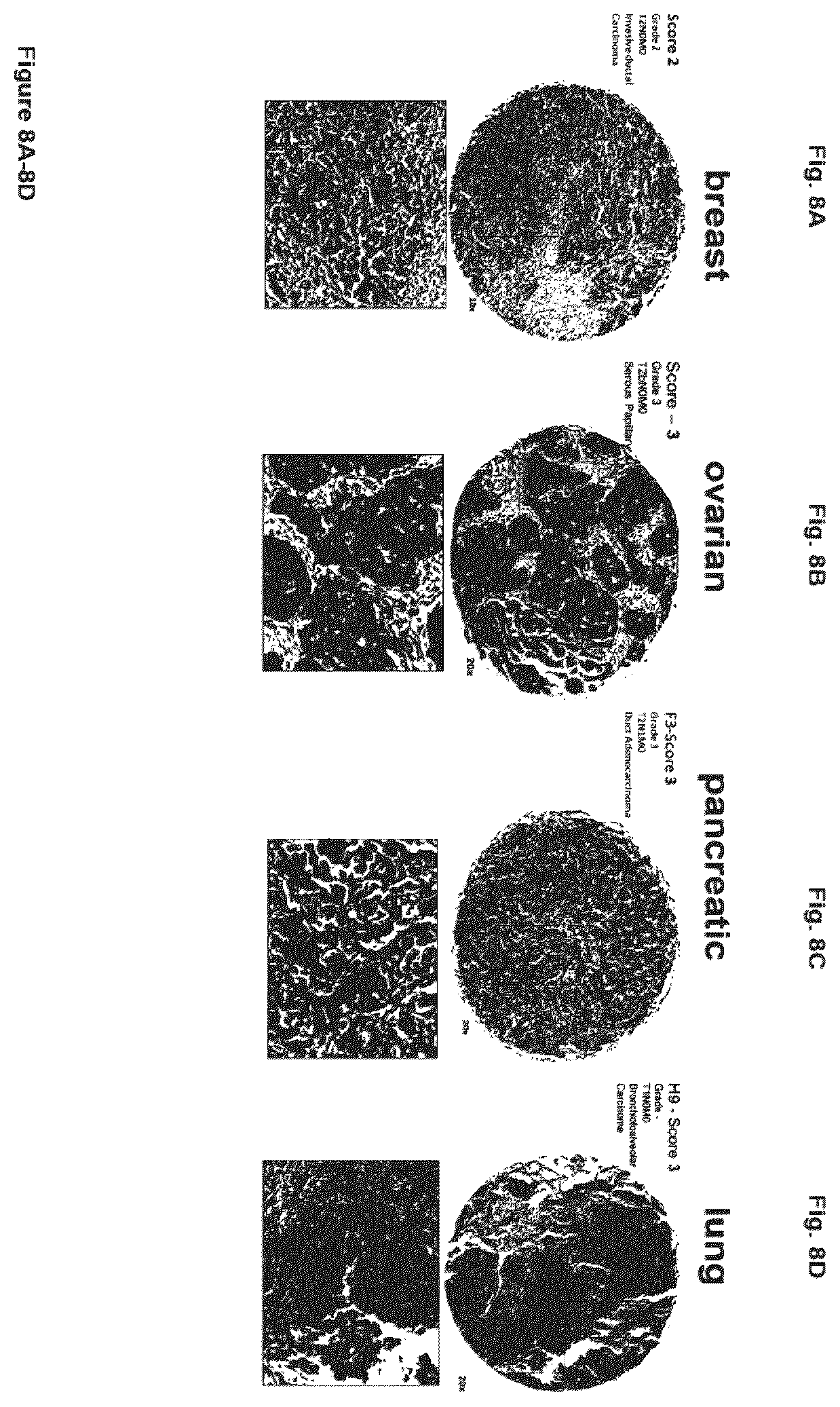Patent US12351646 Figure 8 – Diagnostic methods using anti-MUC1* antibodies