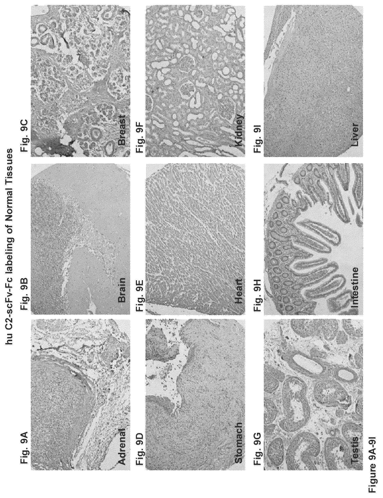 Patent US12351646 Figure 9 – Diagnostic methods using anti-MUC1* antibodies