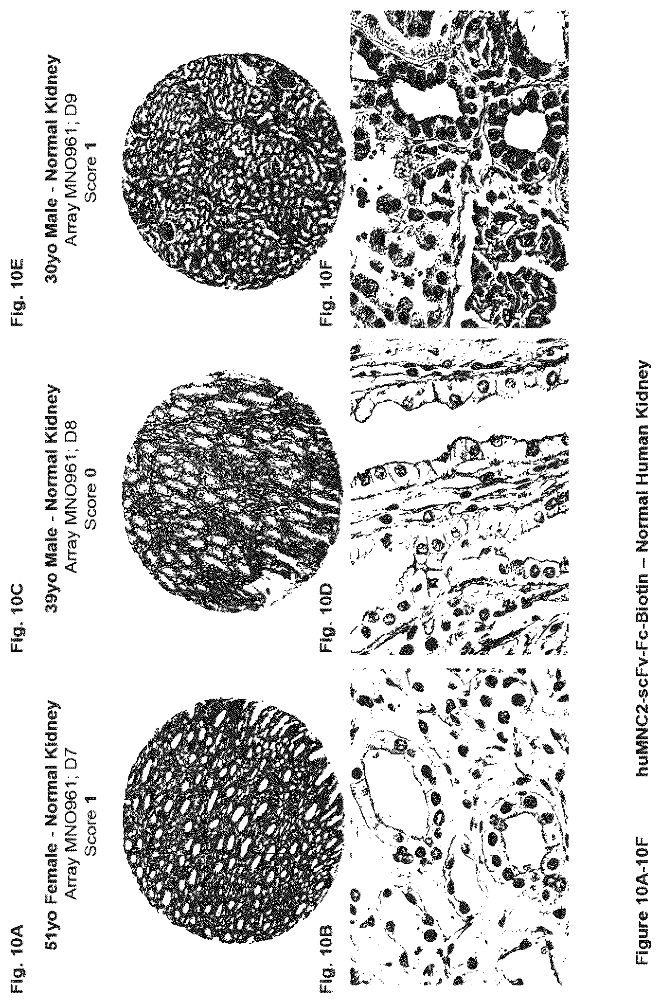 Patent US12351646 Figure 10 – Diagnostic methods using anti-MUC1* antibodies