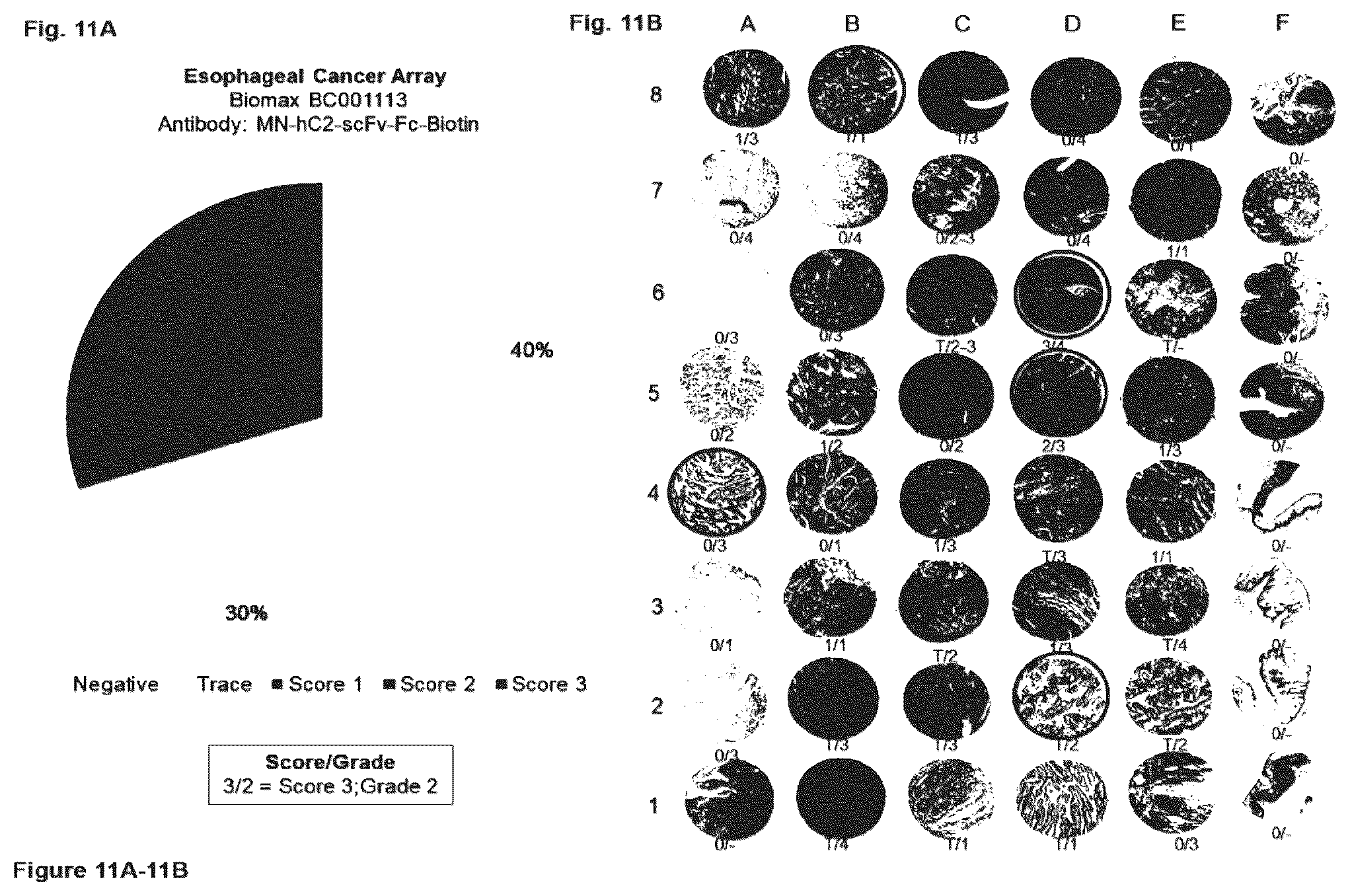 Patent US12351646 Figure 11 – Diagnostic methods using anti-MUC1* antibodies