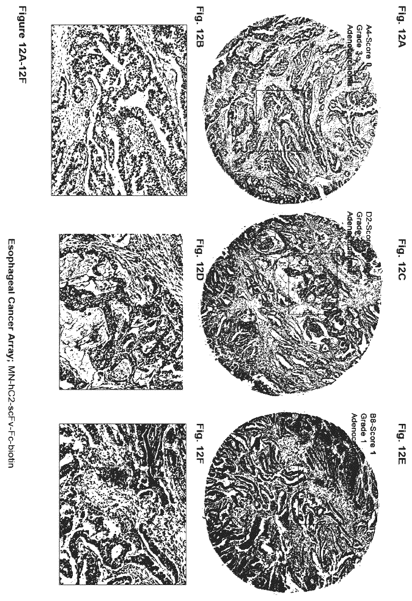 Patent US12351646 Figure 12 – Diagnostic methods using anti-MUC1* antibodies