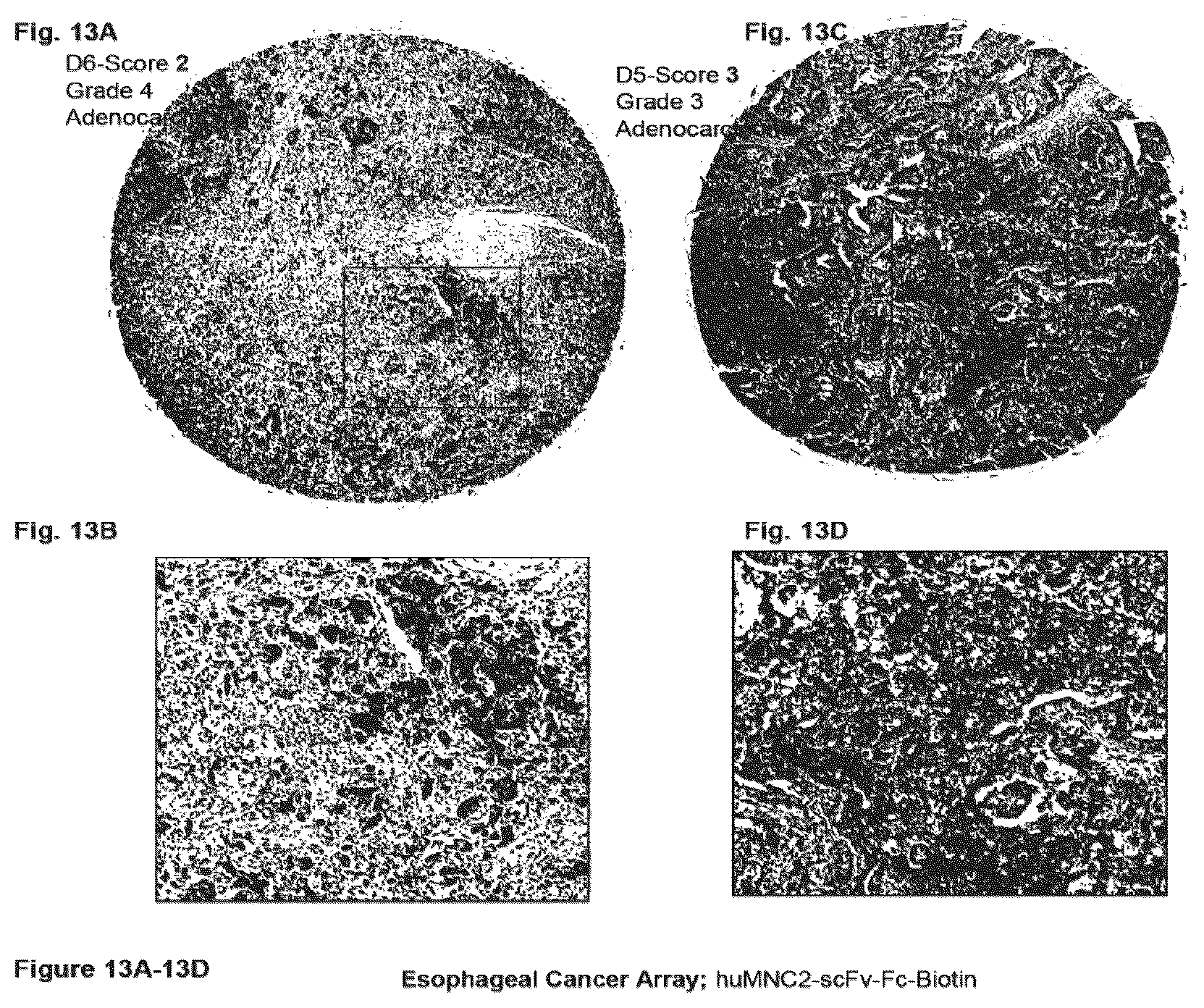 Patent US12351646 Figure 13 – Diagnostic methods using anti-MUC1* antibodies