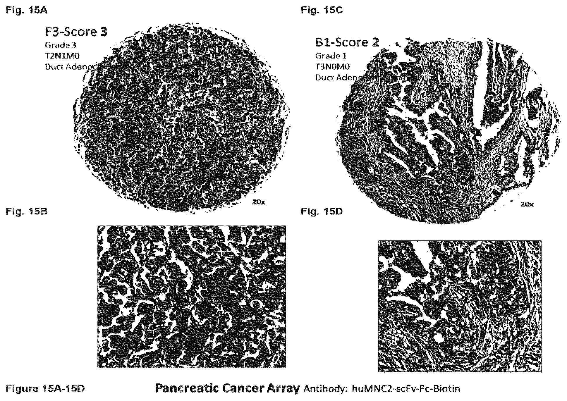 Patent US12351646 Figure 15 – Diagnostic methods using anti-MUC1* antibodies
